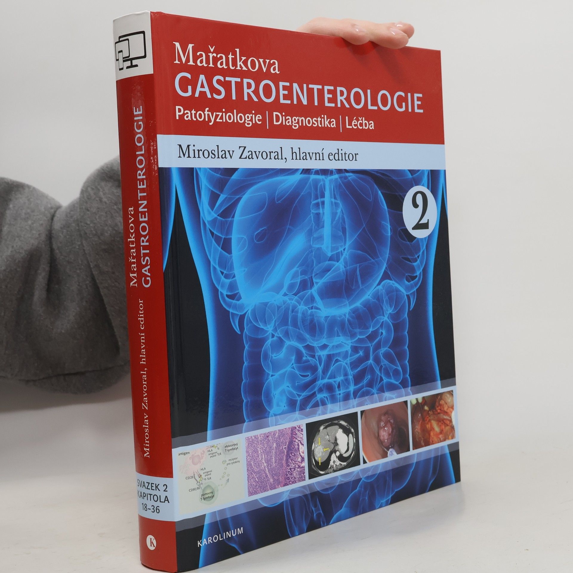 Miroslav Zavoral Mařatkova gastroenterologie: Patofyziologie / Diagnostika / Léčba