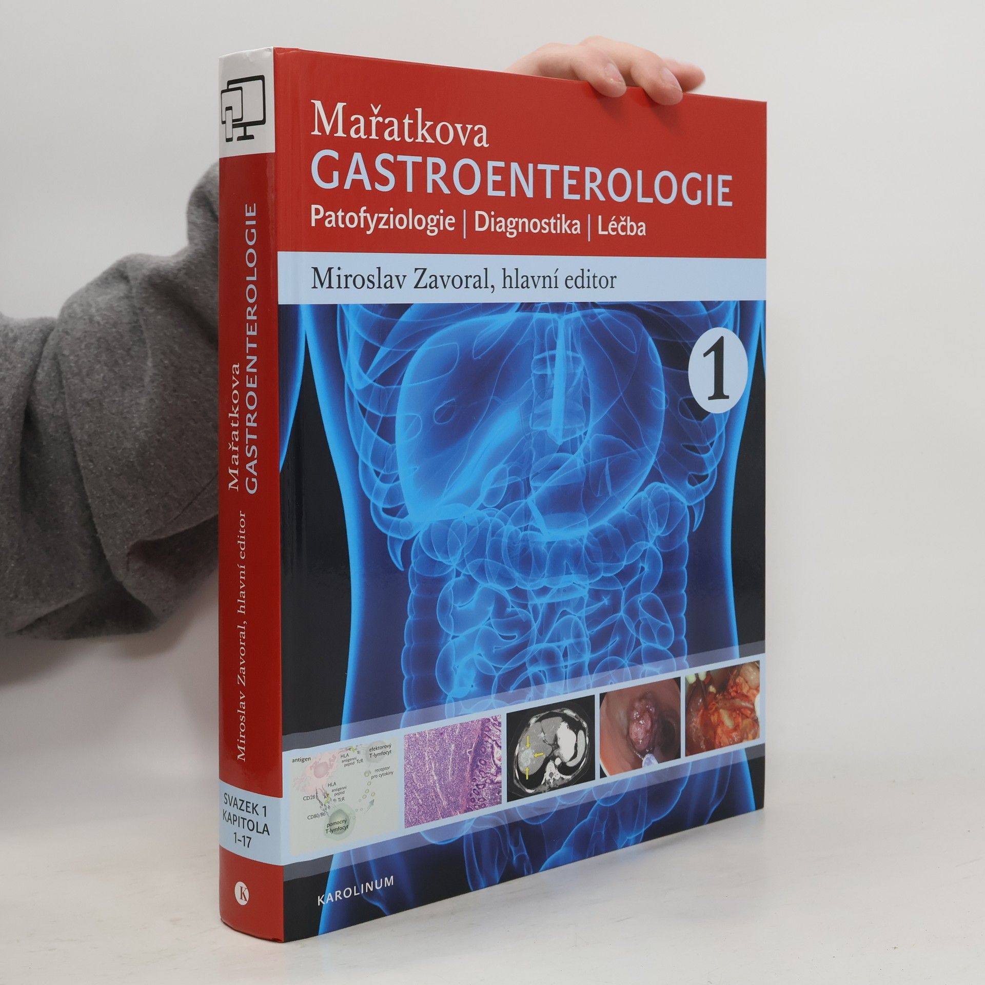 Miroslav Zavoral Mařatkova gastroenterologie: Patofyziologie / Diagnostika / Léčba