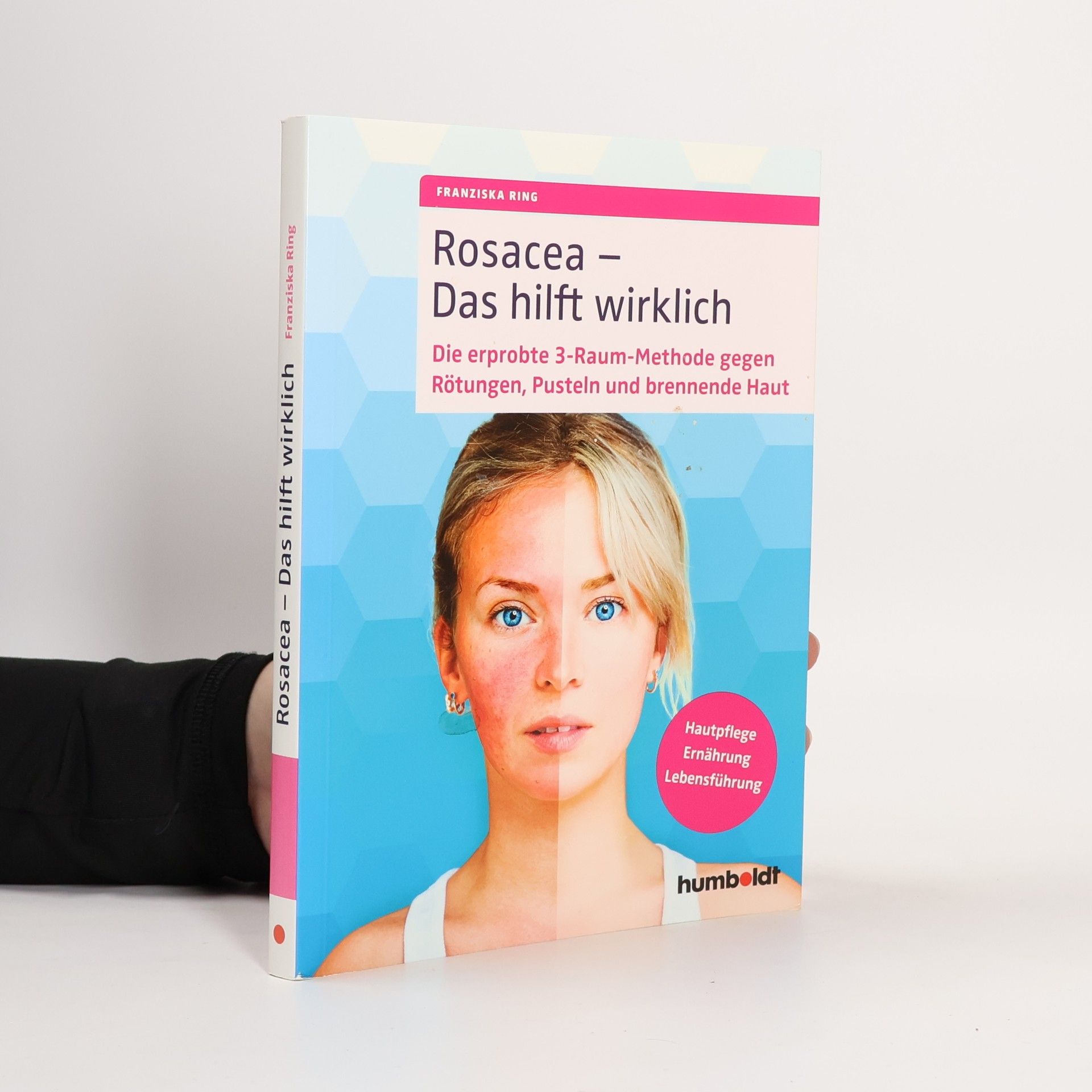 Franziska Ring Rosacea - das hilft wirklich