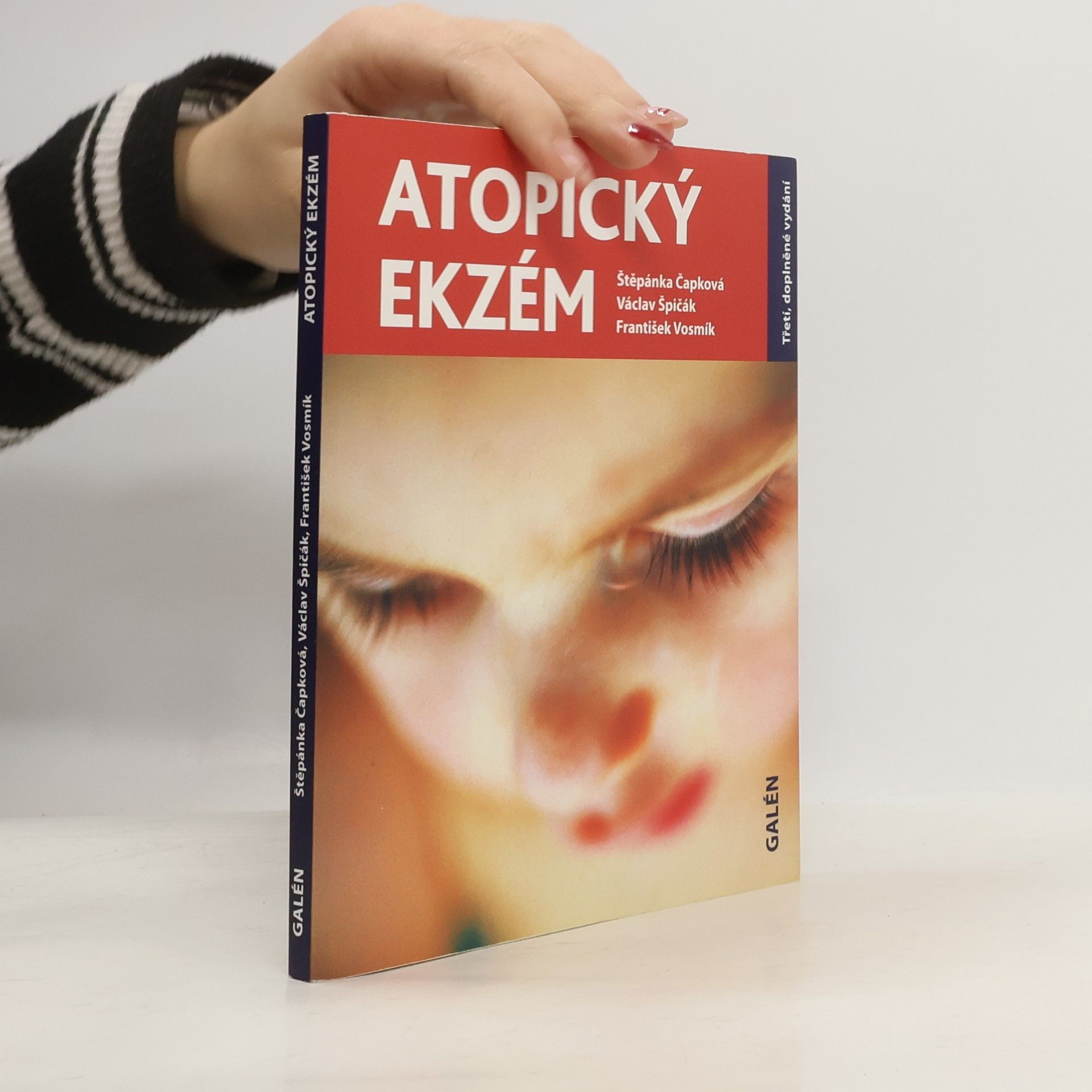 Štěpánka Čapková Atopický ekzém