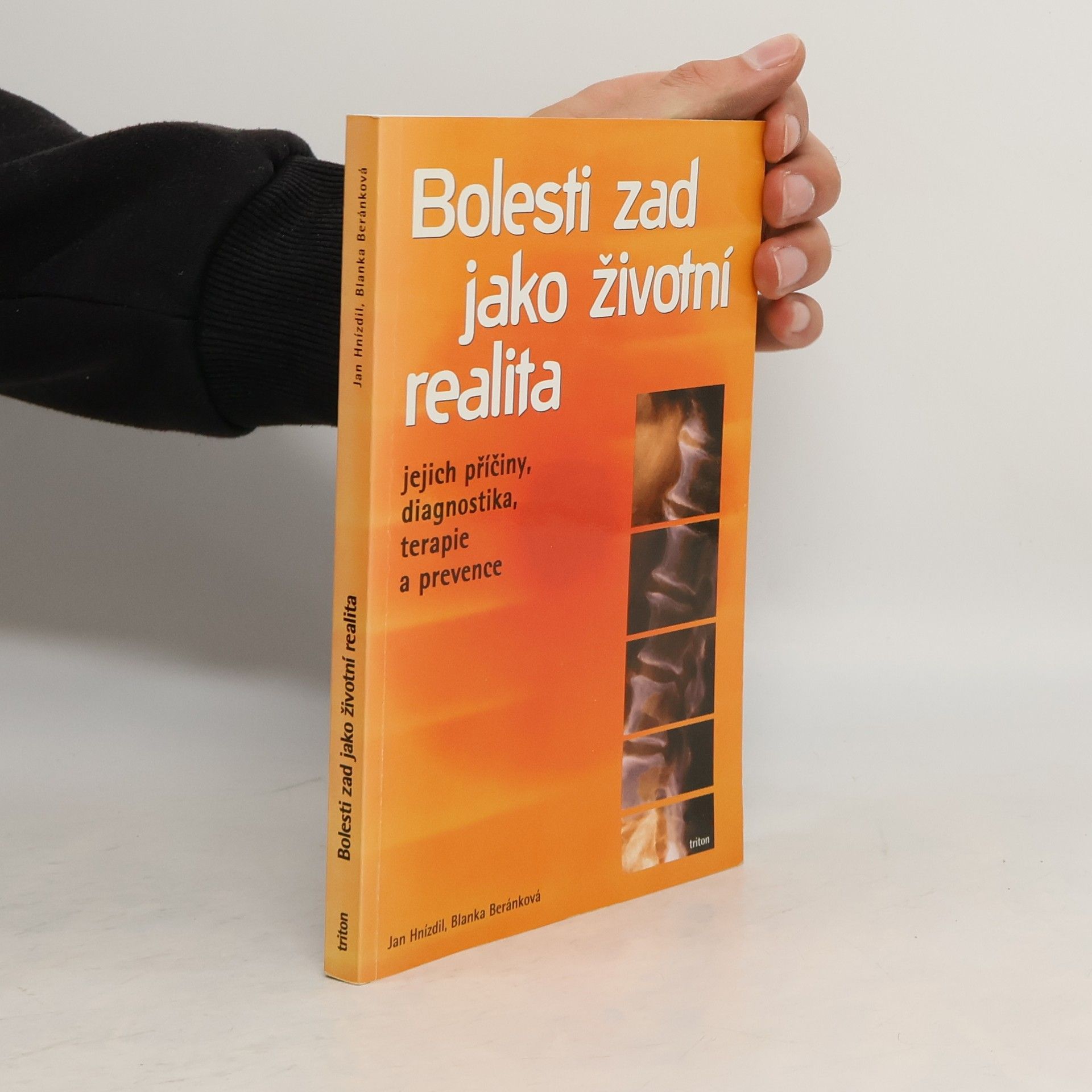 Jan Hnízdil Bolesti zad jako životní realita. Jejich příčiny, diagnostika, terapie a prevence