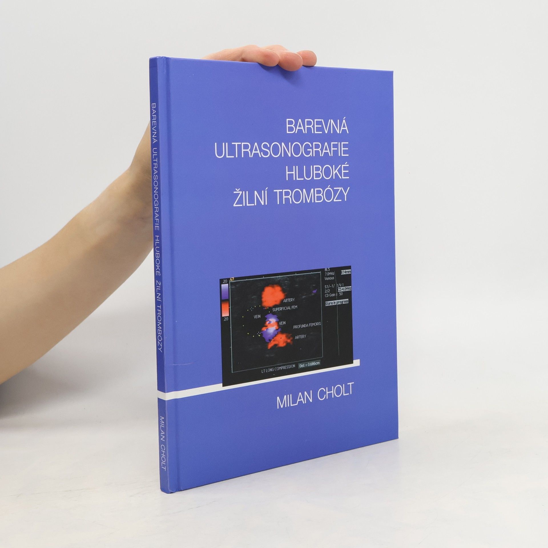Milan Cholt Barevná ultrasonografie hluboké žilní trombózy