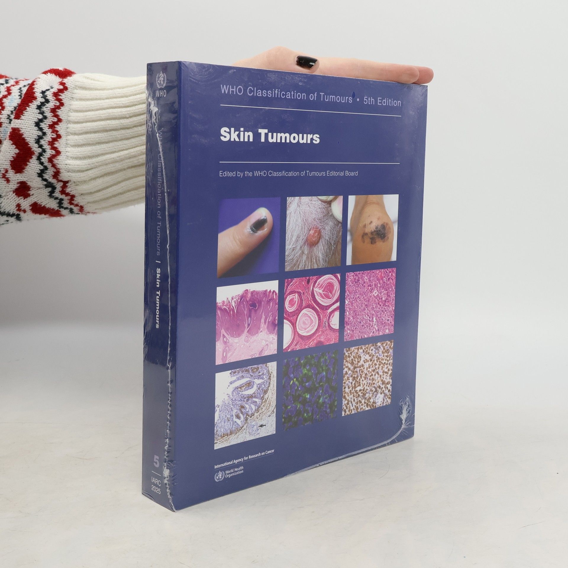 WHO Classification of Tumours Editorial Board Skin Tumours
