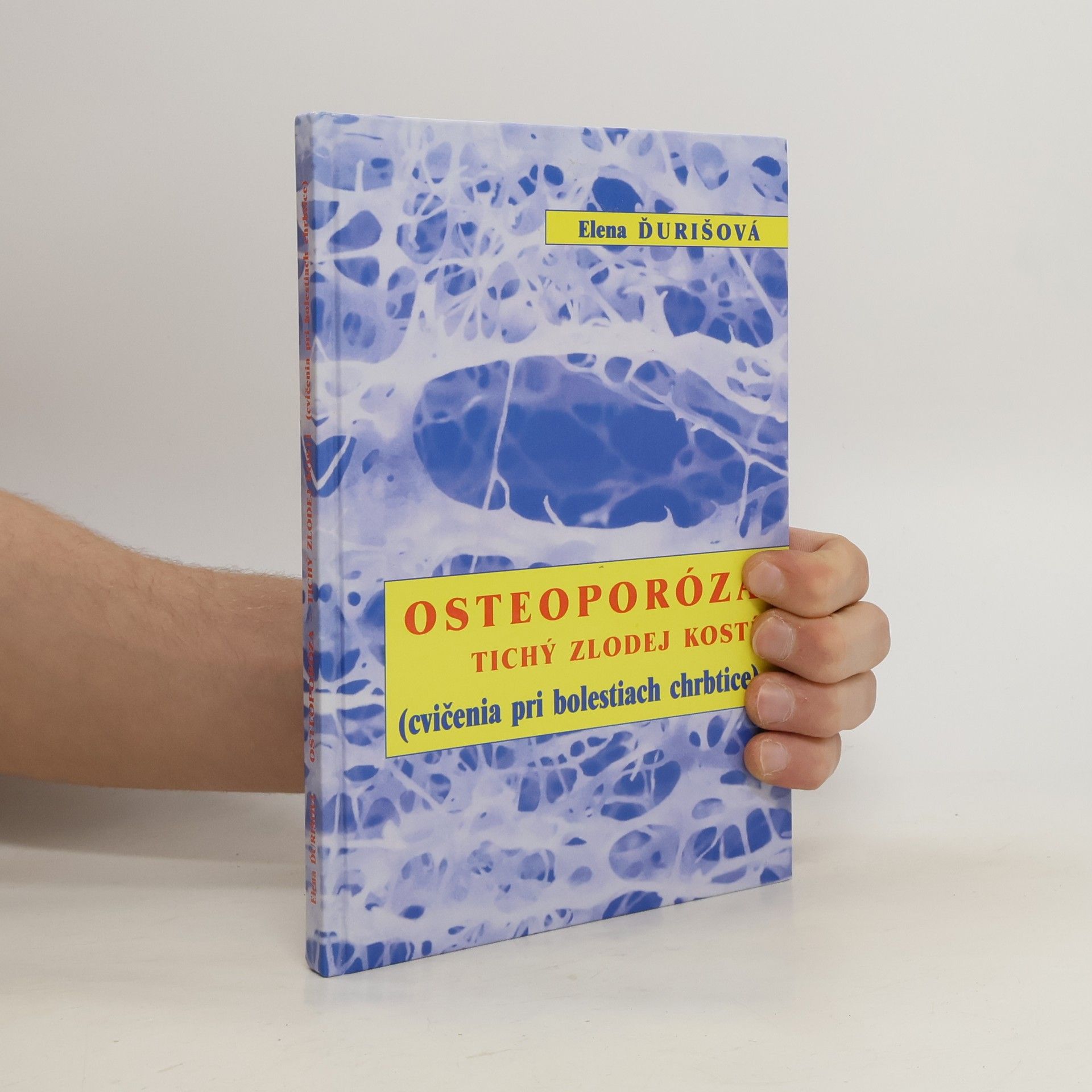 Osteoporóza. Tichý zlodej kostí