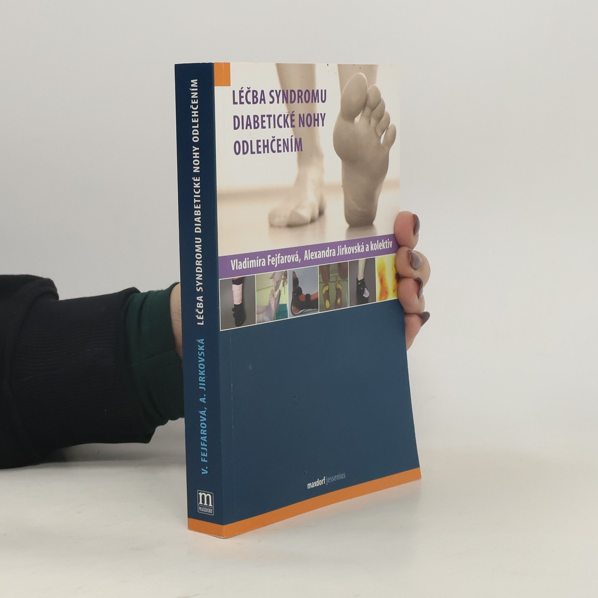 Alexandra Jirkovská Léčba syndromu diabetické nohy odlehčením