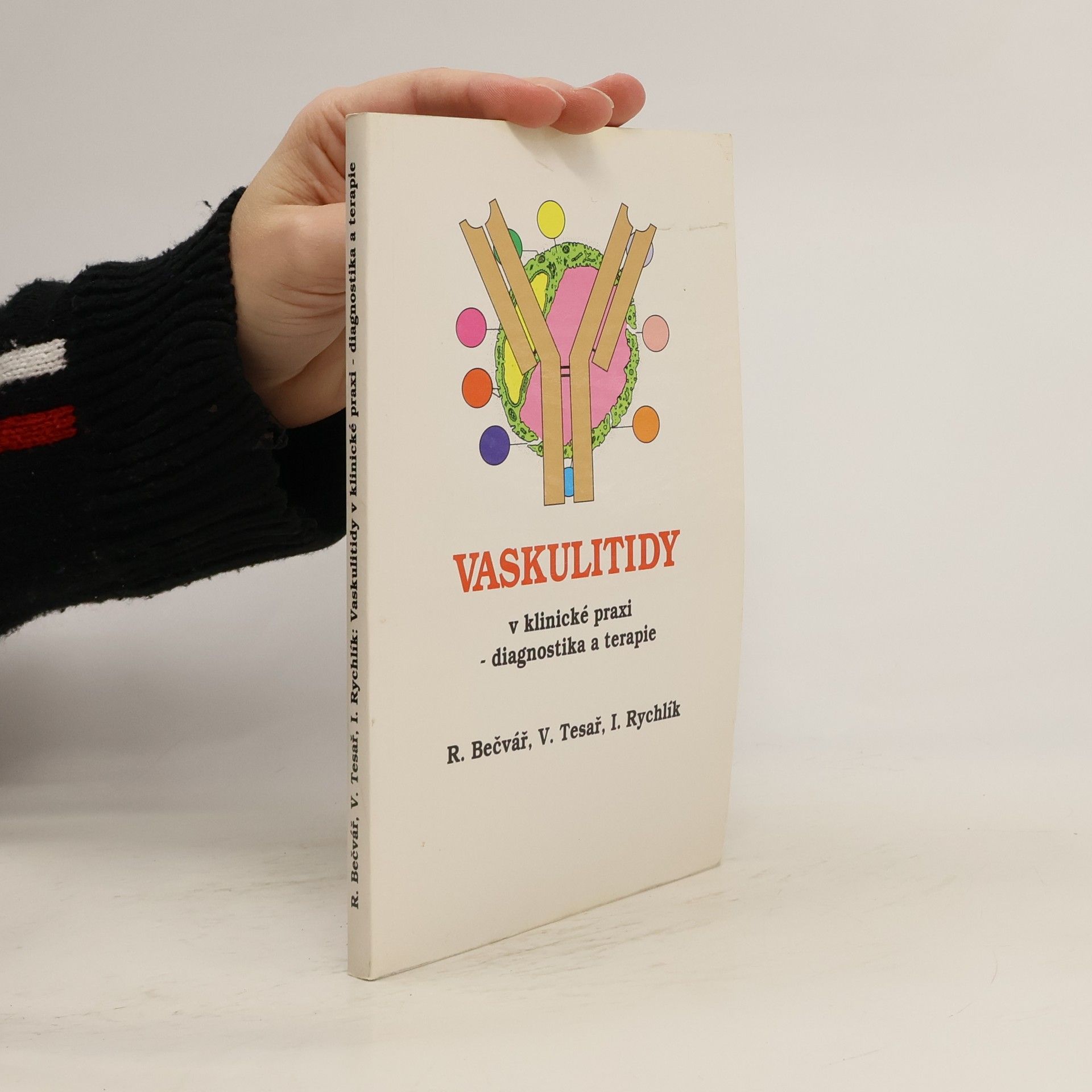 Vaskulitidy v klinické praxi - diagnostika a terapie