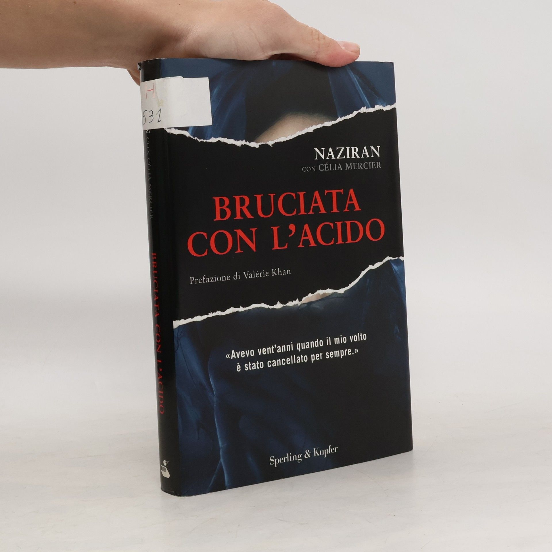 Bruciata con l'acido