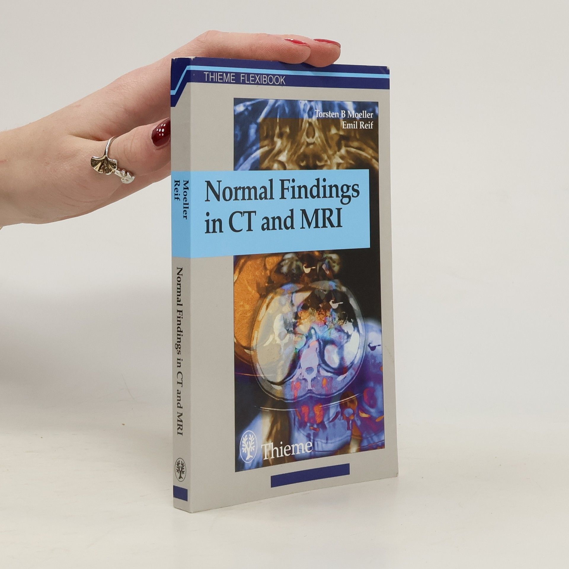 Torsten Bert Moeller Thieme Flexibook: Normal Findings in CT and MRI