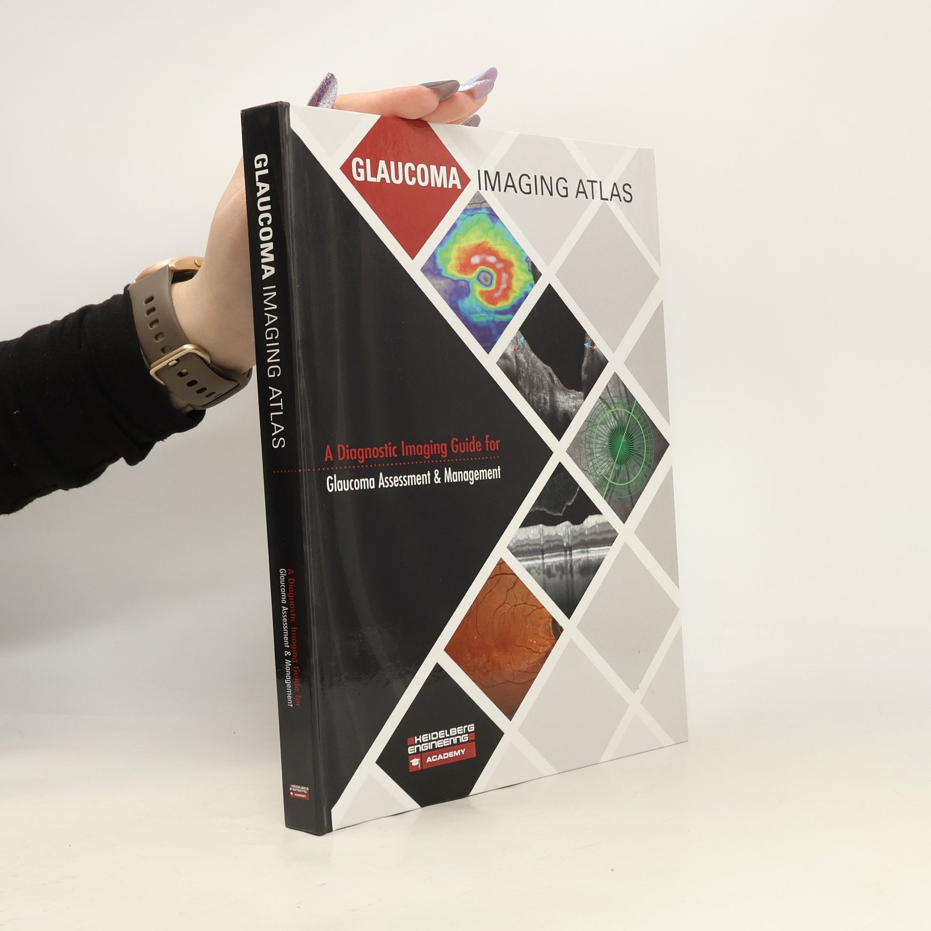 Autores varios Glaucoma Imaging Atlas