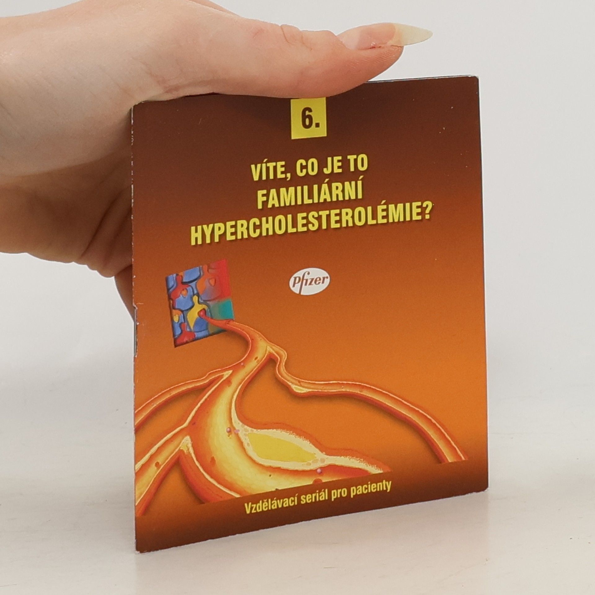 Auteurscollectief Víte, co je to familiární hypercholesterolémie?