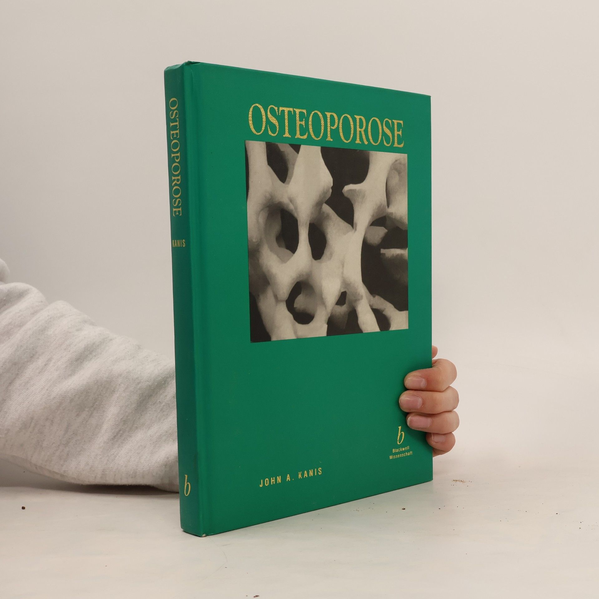 John A. Kanis Osteoporose