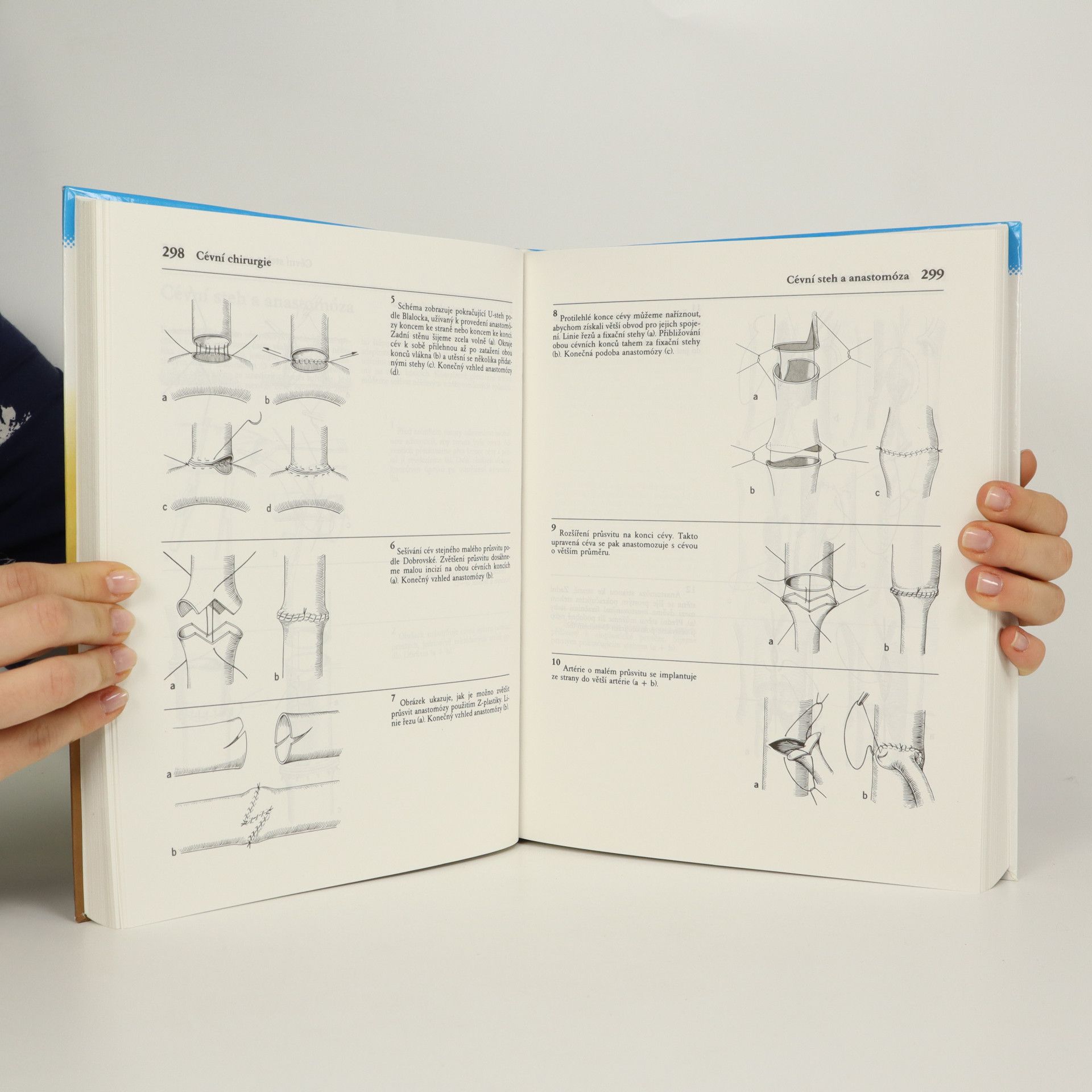 Horst Eberhard Grewe Atlas chirurgických operací