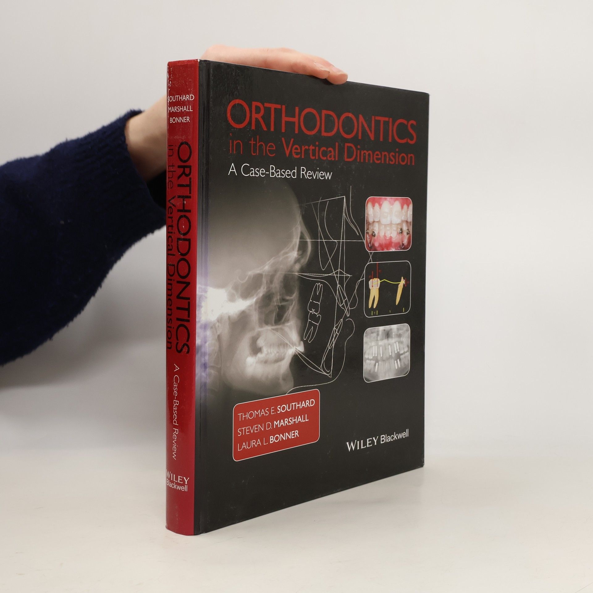 Thomas E. Southard Orthodontics in the Vertical Dimension