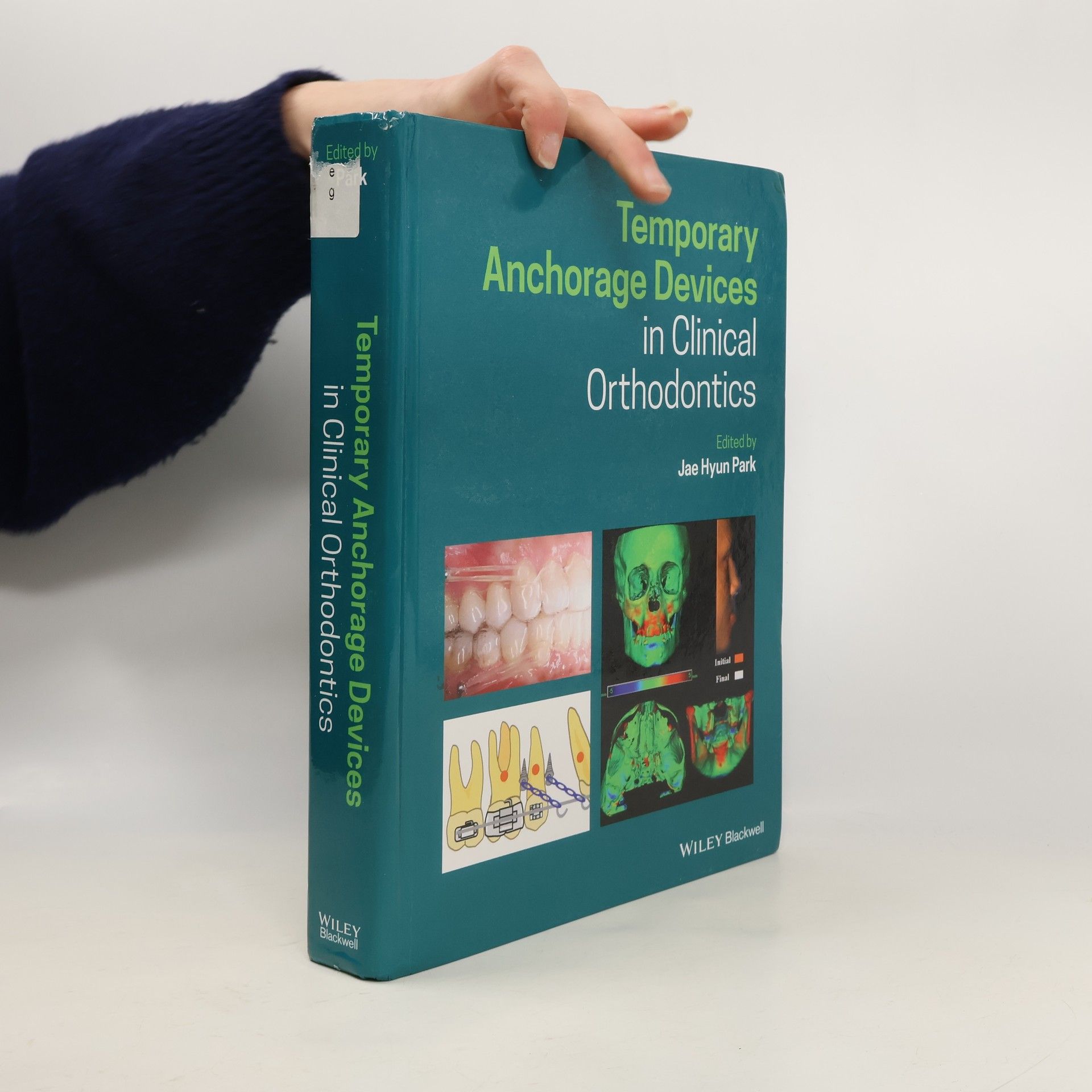 Jae Hyun Park Temporary Anchorage Devices in Clinical Orthodontics