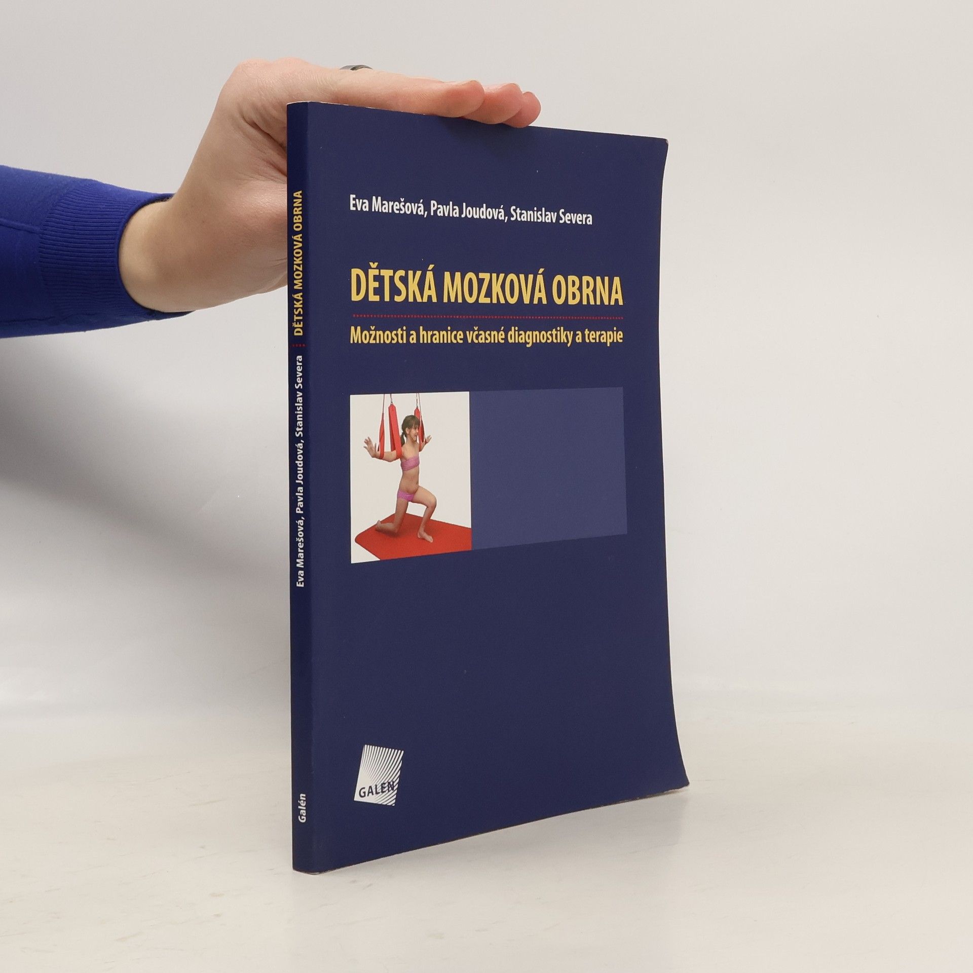 Eva Marešová Dětská mozková obrna : možnosti a hranice včasné diagnostiky a terapie