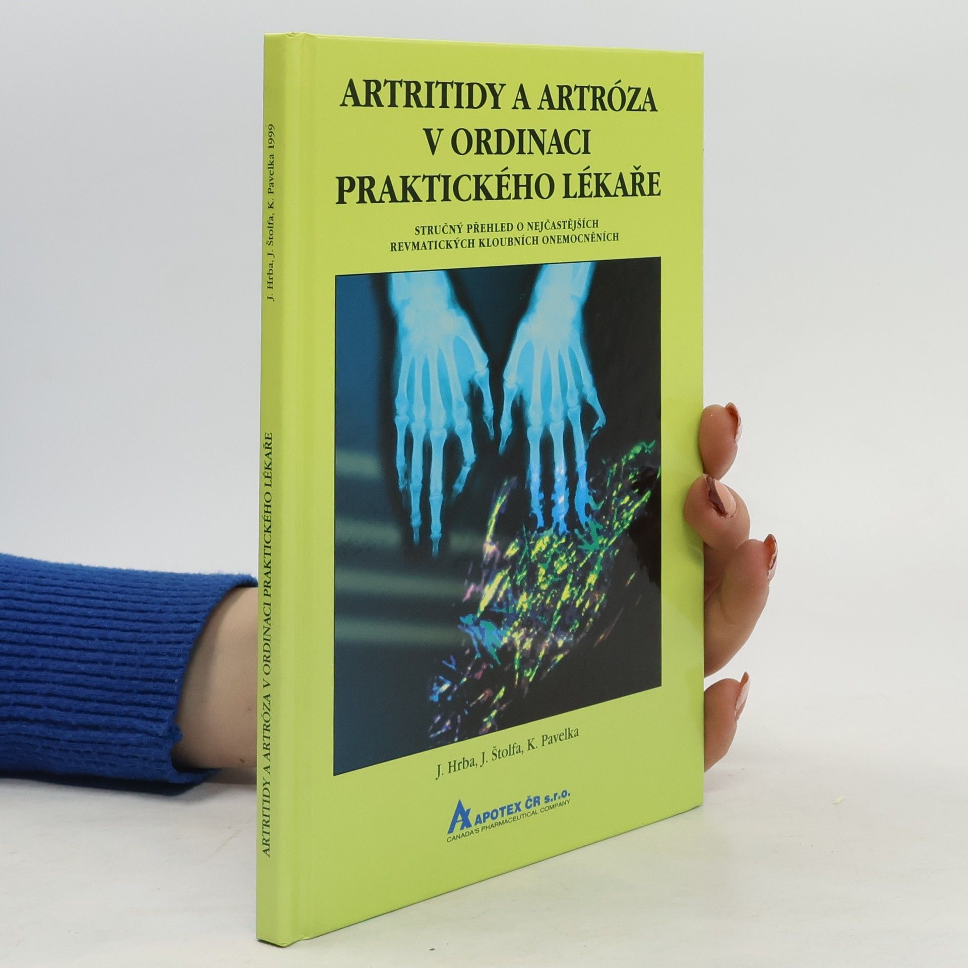 Artritidy a artróza v ordinaci praktického lékaře