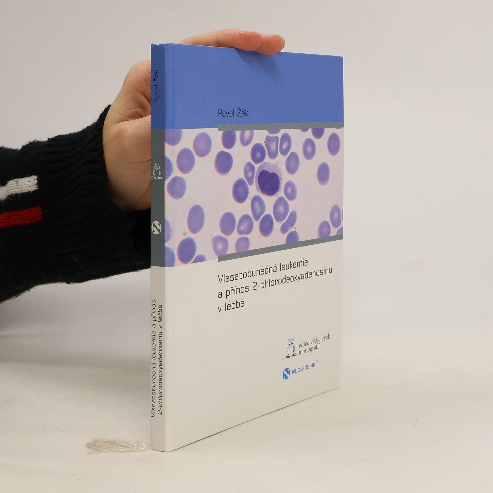 Vlasatobuněčná leukemie a přínos 2-chlorodeoxyadenosinu v léčbě