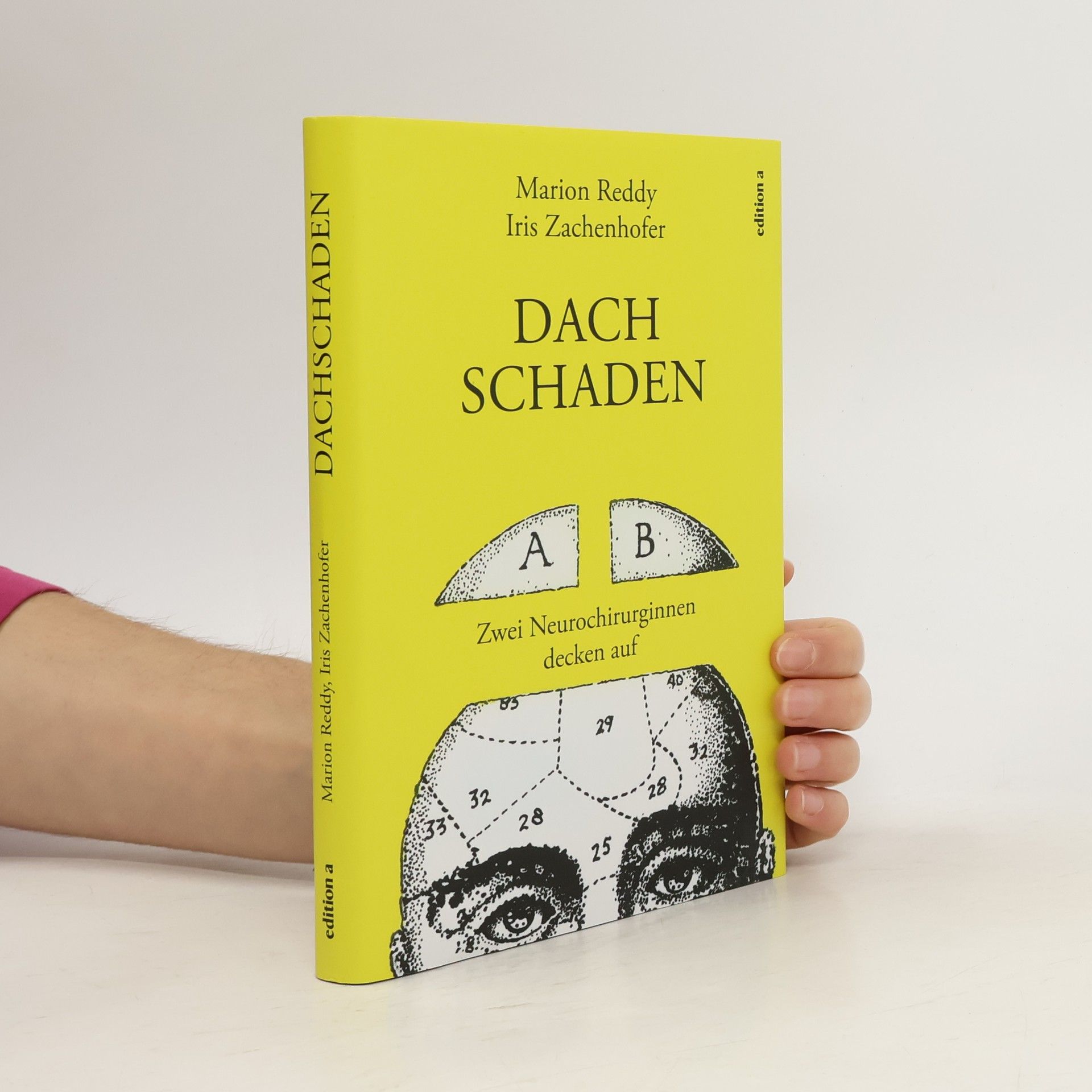 Marion Reddy Dachschaden