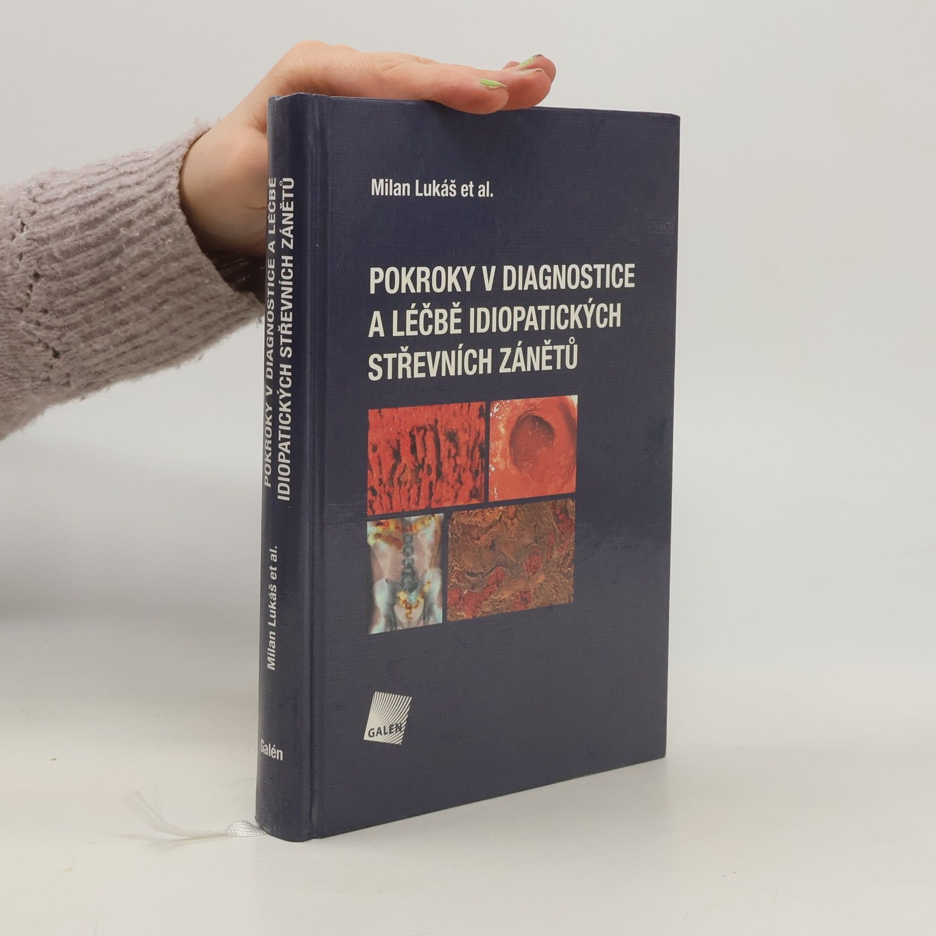 Pokroky v diagnostice a léčbě idiopatických střevních zánětů