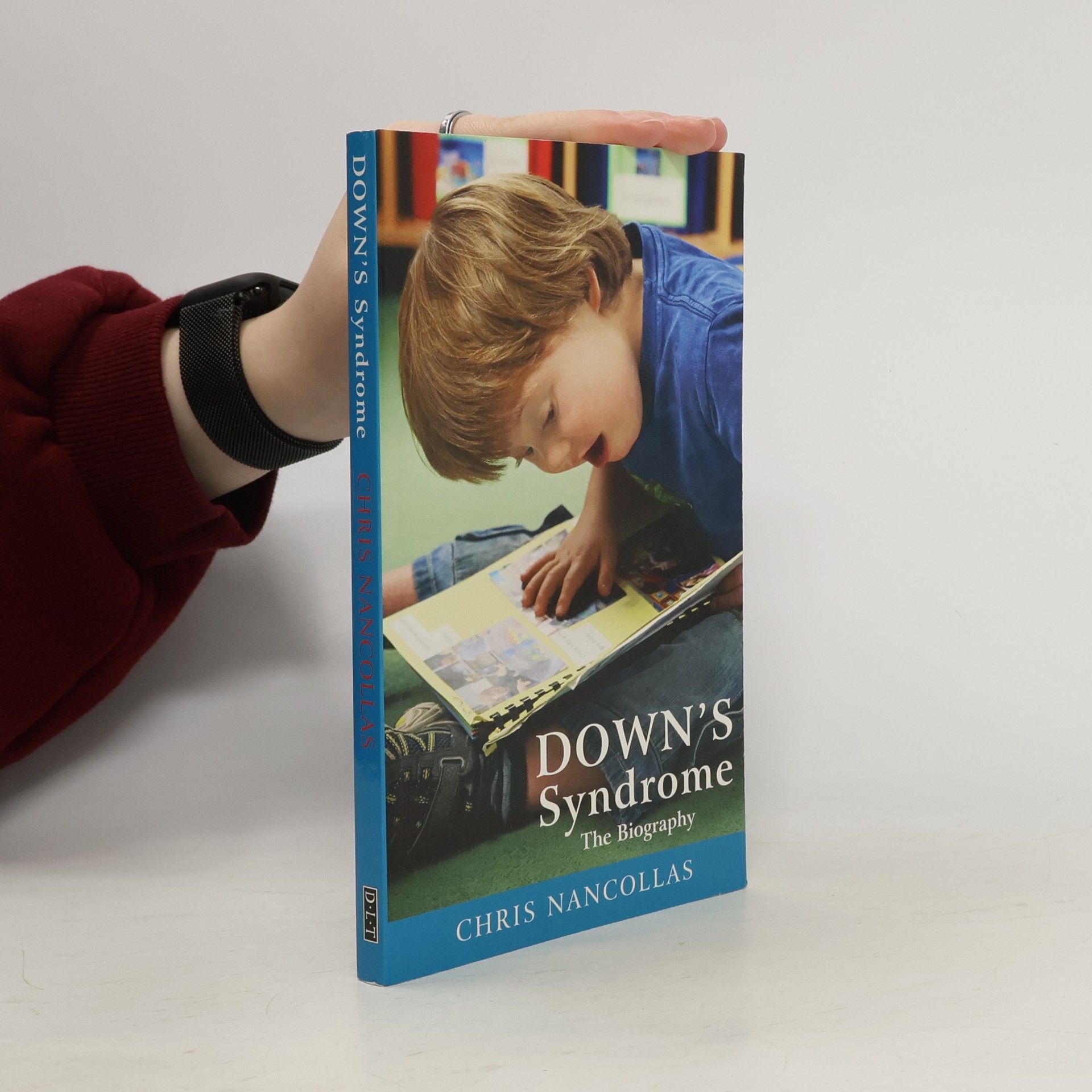 Dr Chris Nancollas Down Syndrome