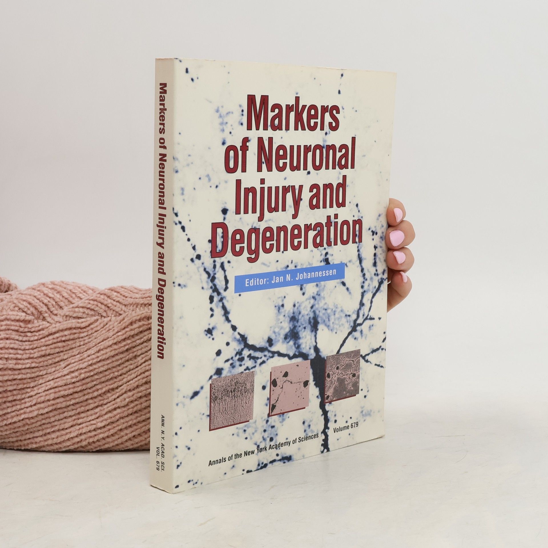 Jan N. Johannessen Annals of the New York Academy of Sciences - 679: Markers of Neuronal Injury and Degeneration