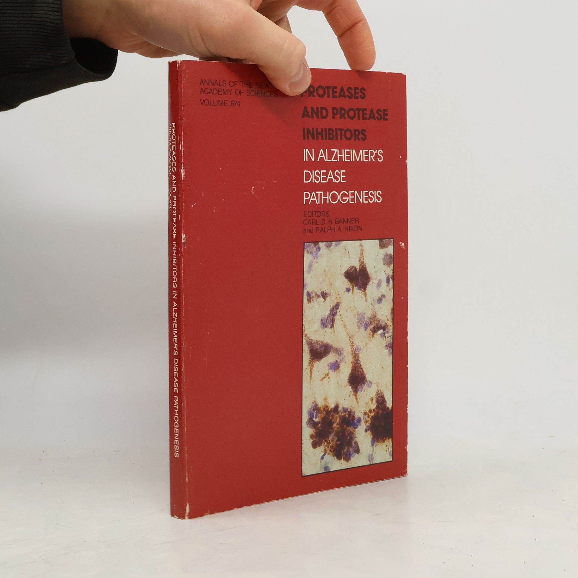 Ralph A. Nixon Annals Of The New York Academy Of Sciences - 674: Proteases And Protease Inhibitors In Alzheimer's Disease Pathogenesis