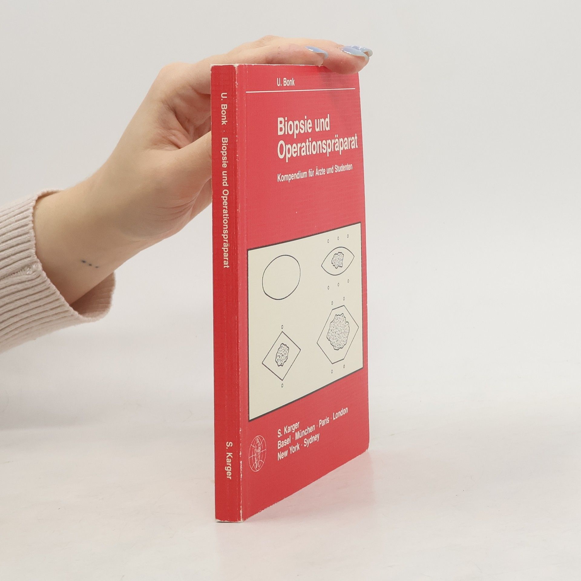 Ulrich E. W. Bonk Biopsie und Operationspräparat