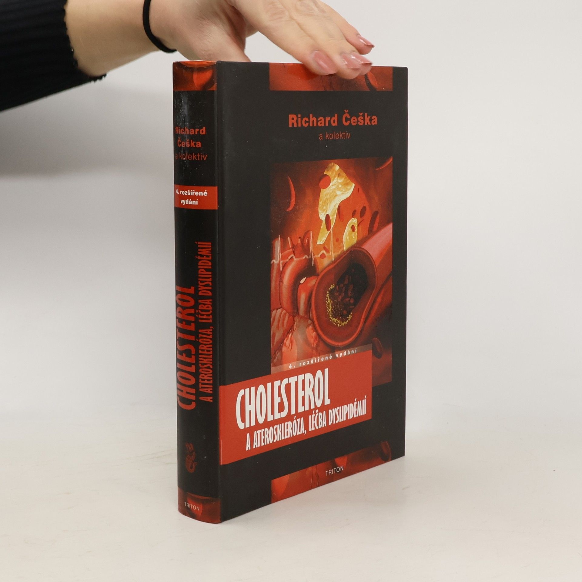Richard Češka Cholesterol a ateroskleróza, léčba dyslipidémií