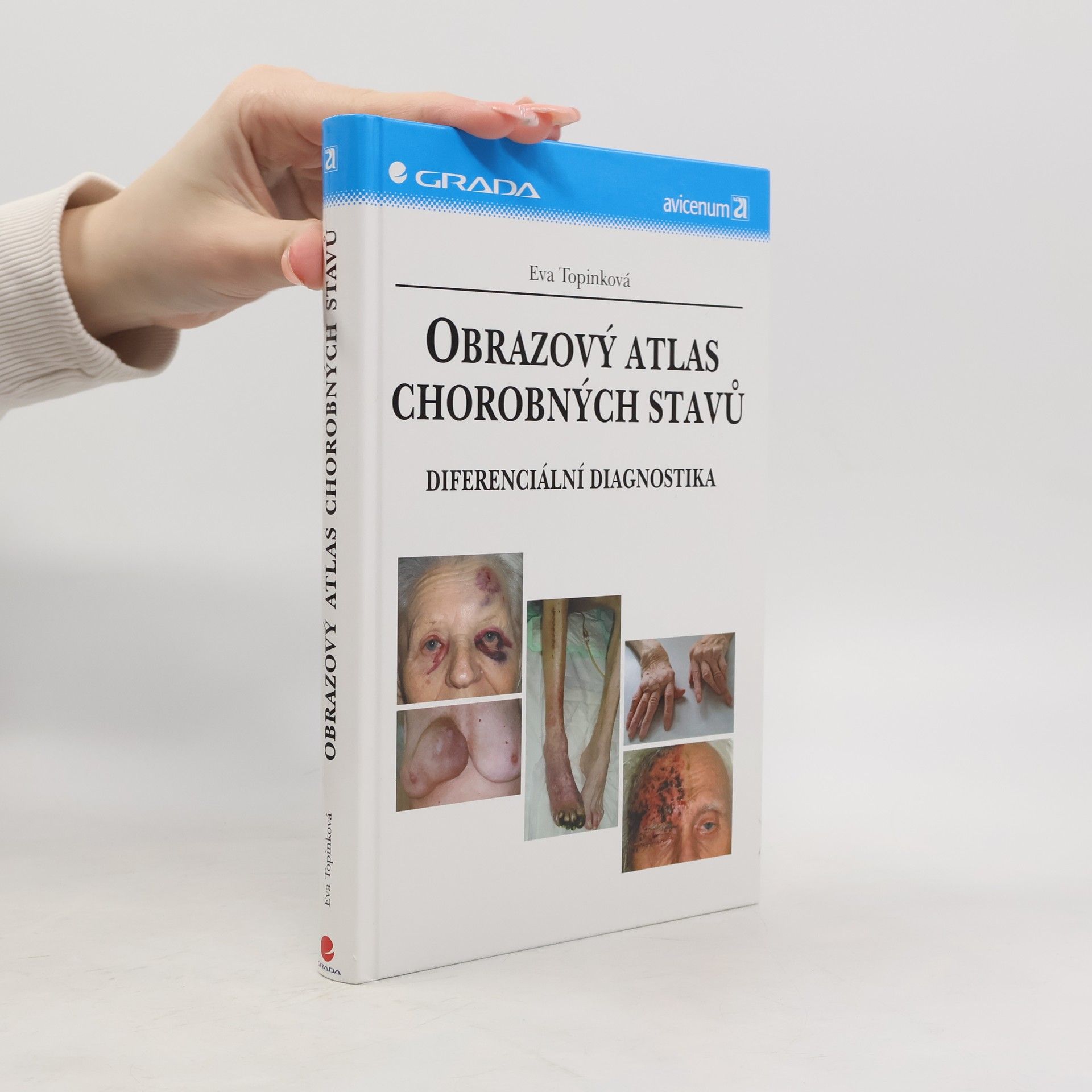 Eva Topinková Obrazový atlas chorobných stavů : diferenciální diagnostika