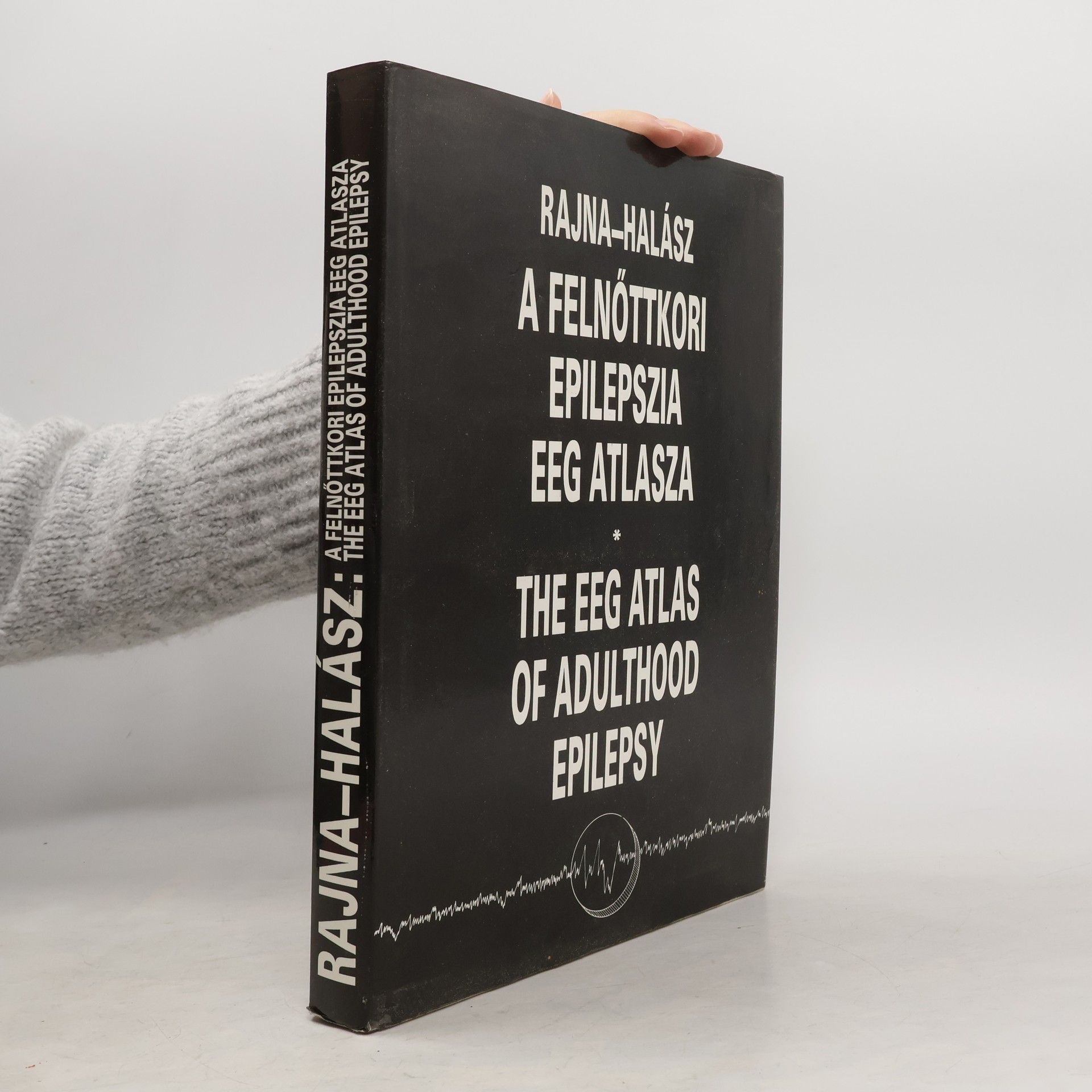 EEG Atlas of Adulthood Epilepsy