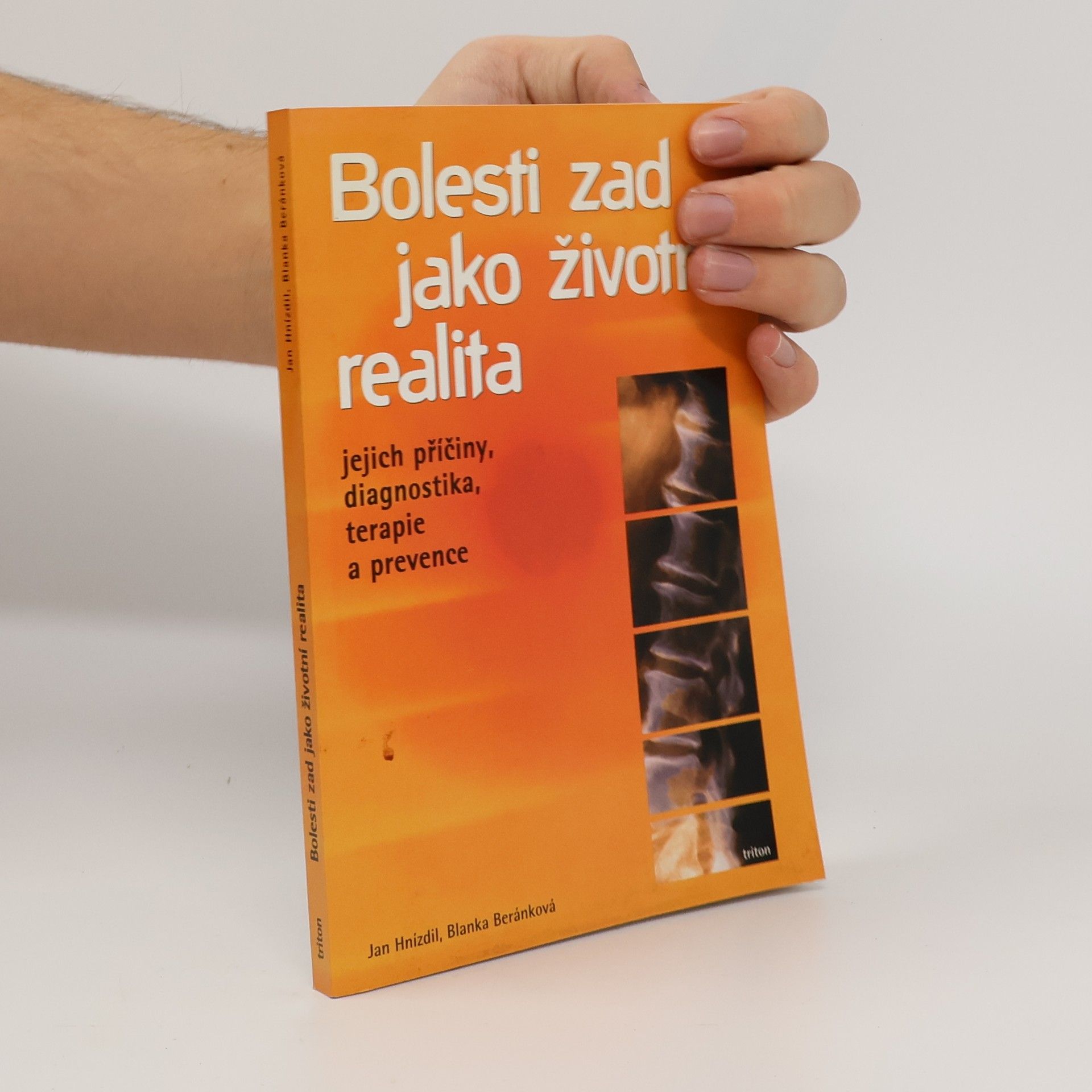 Jan Hnízdil Bolesti zad jako životní realita. Jejich příčiny, diagnostika, terapie a prevence