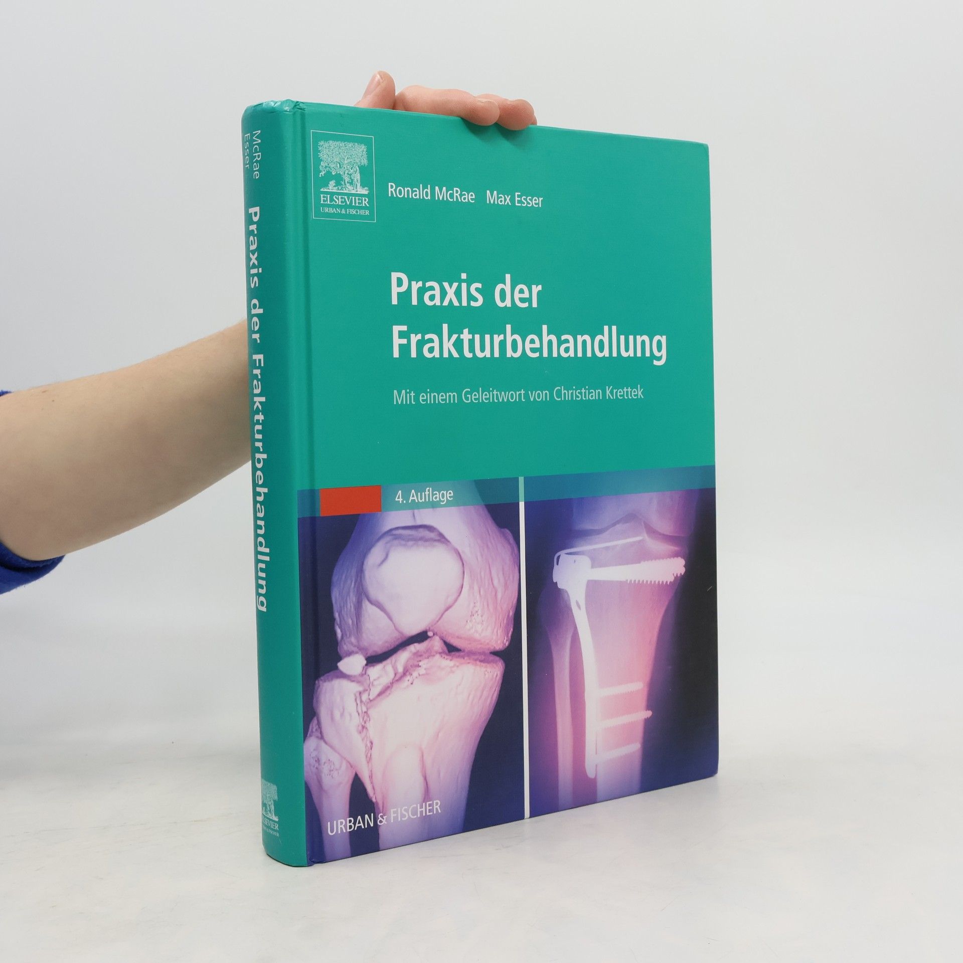 Praxis der Frakturbehandlung - 4. Auflage