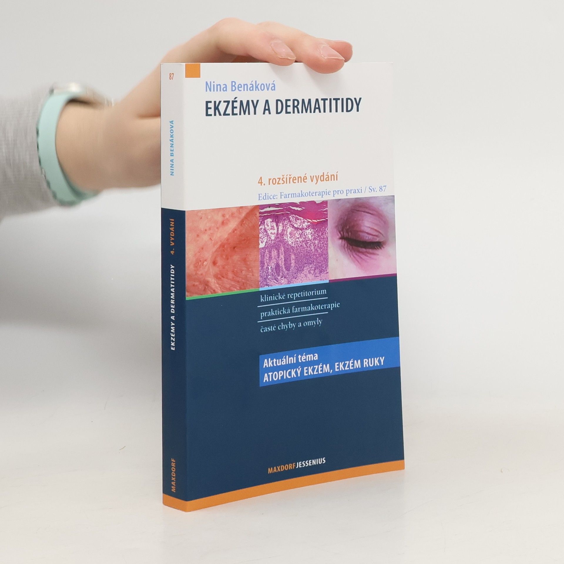 Nina Benáková Ekzémy a dermatitidy