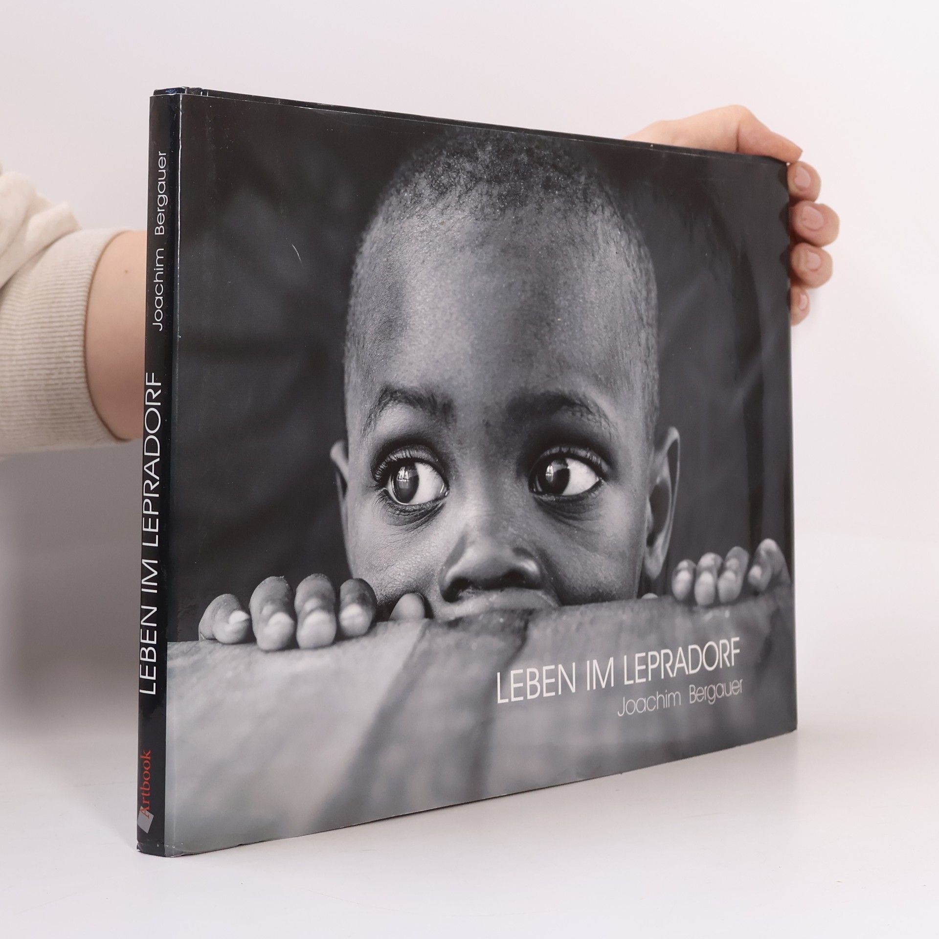 Joachim Bergauer Leben im Lepradorf
