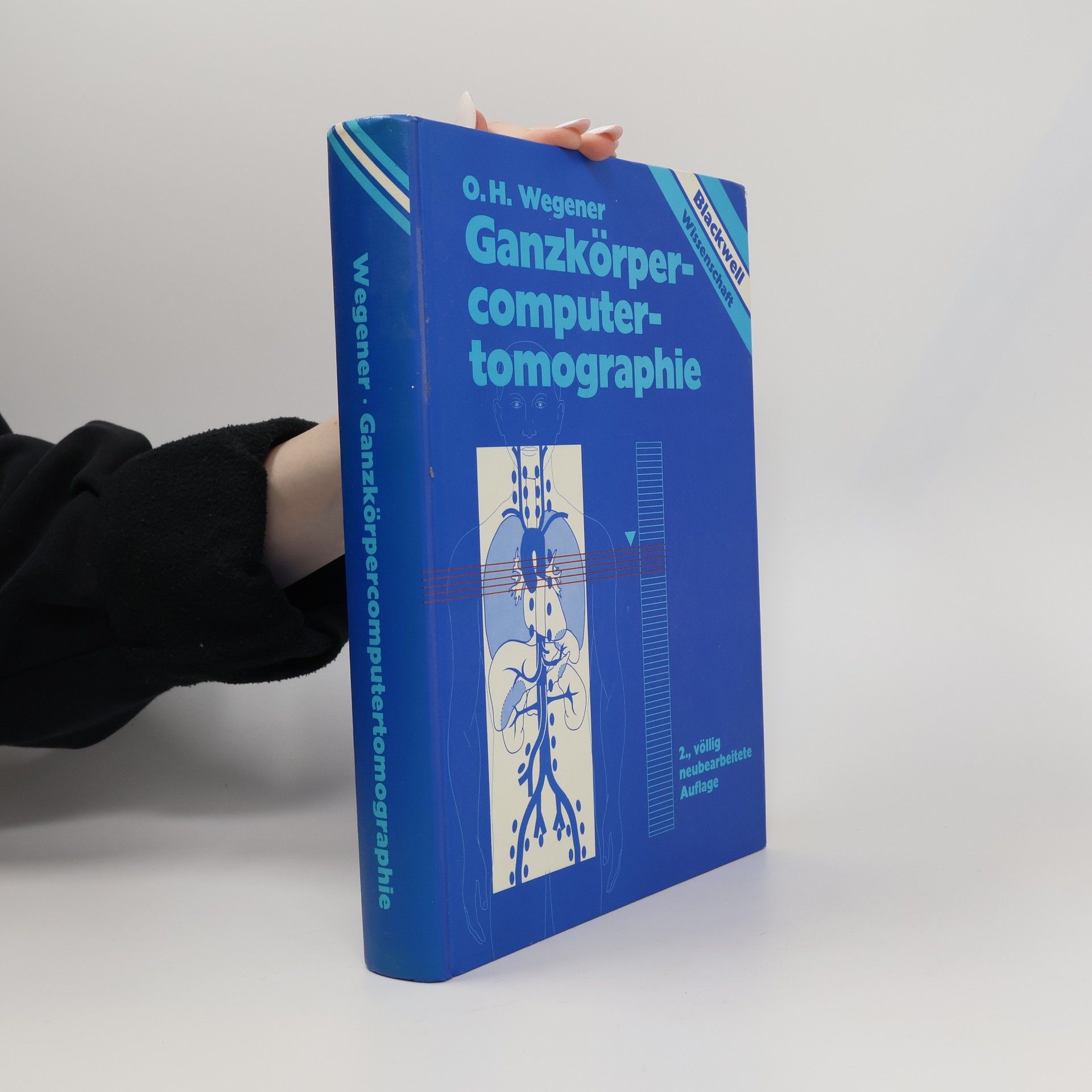 Ganzkörpercomputertomographie