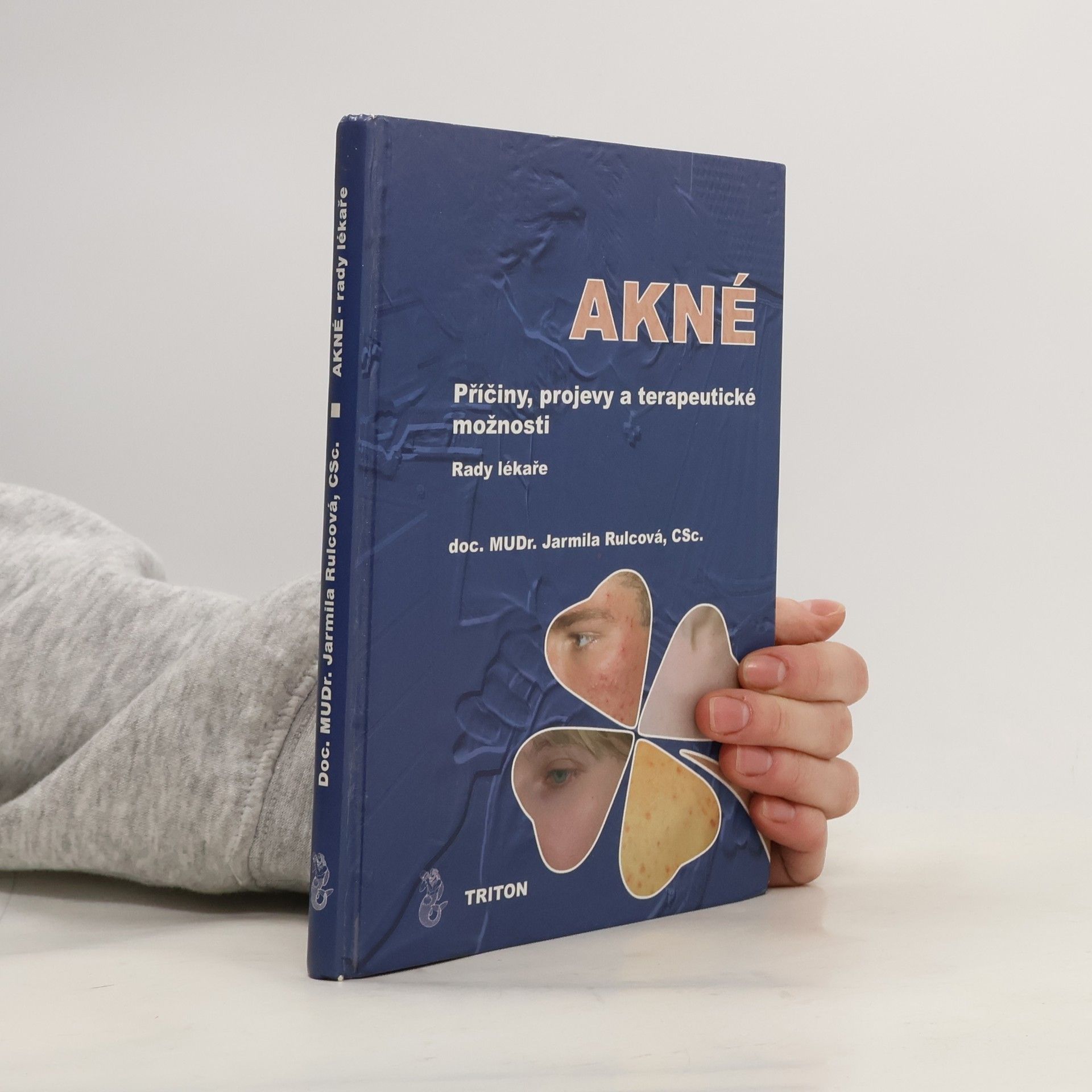 Jarmila Rulcová Akné: příčiny, projevy a terapeutické možnosti: rady lékaře