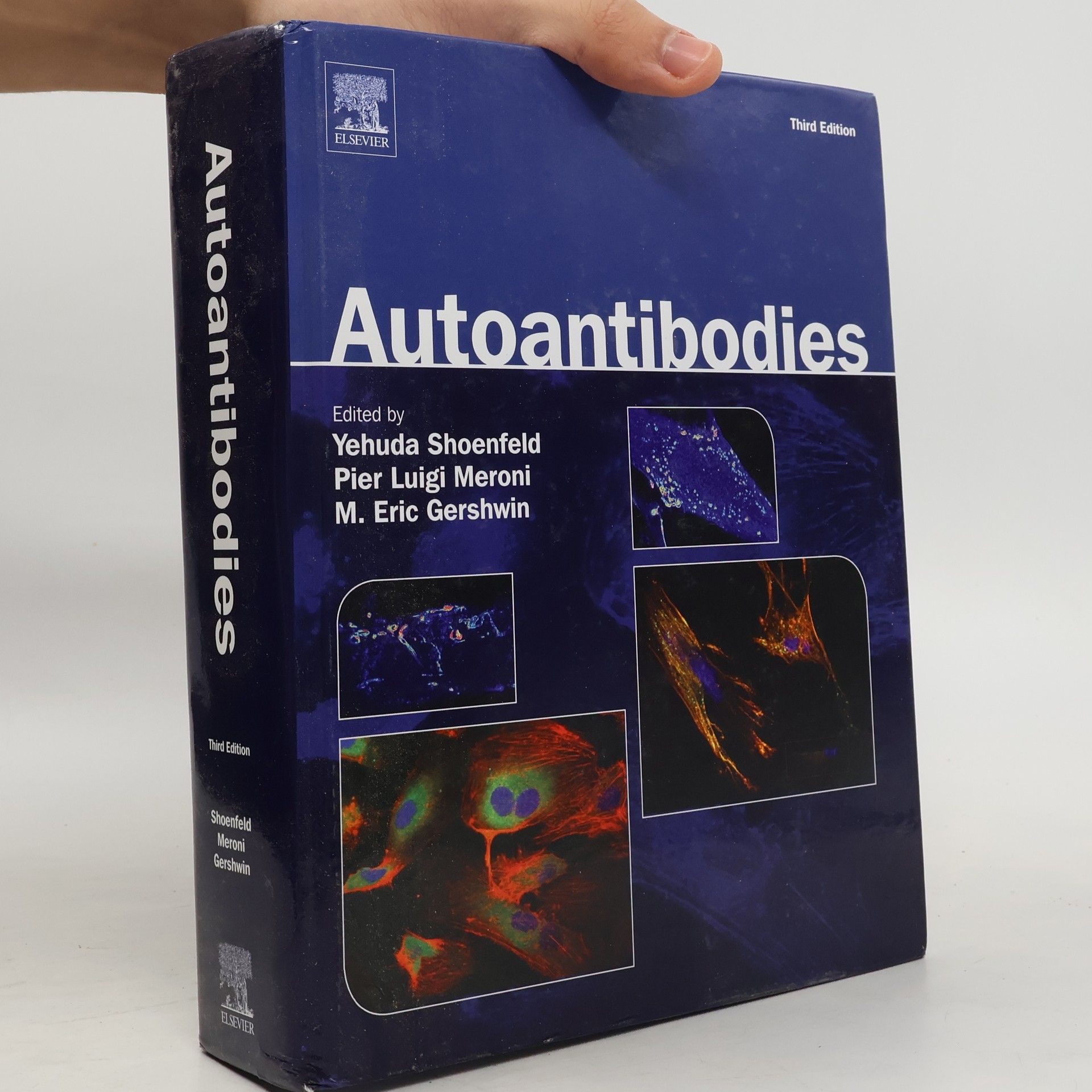 Yehuda Shoenfeld Autoantibodies