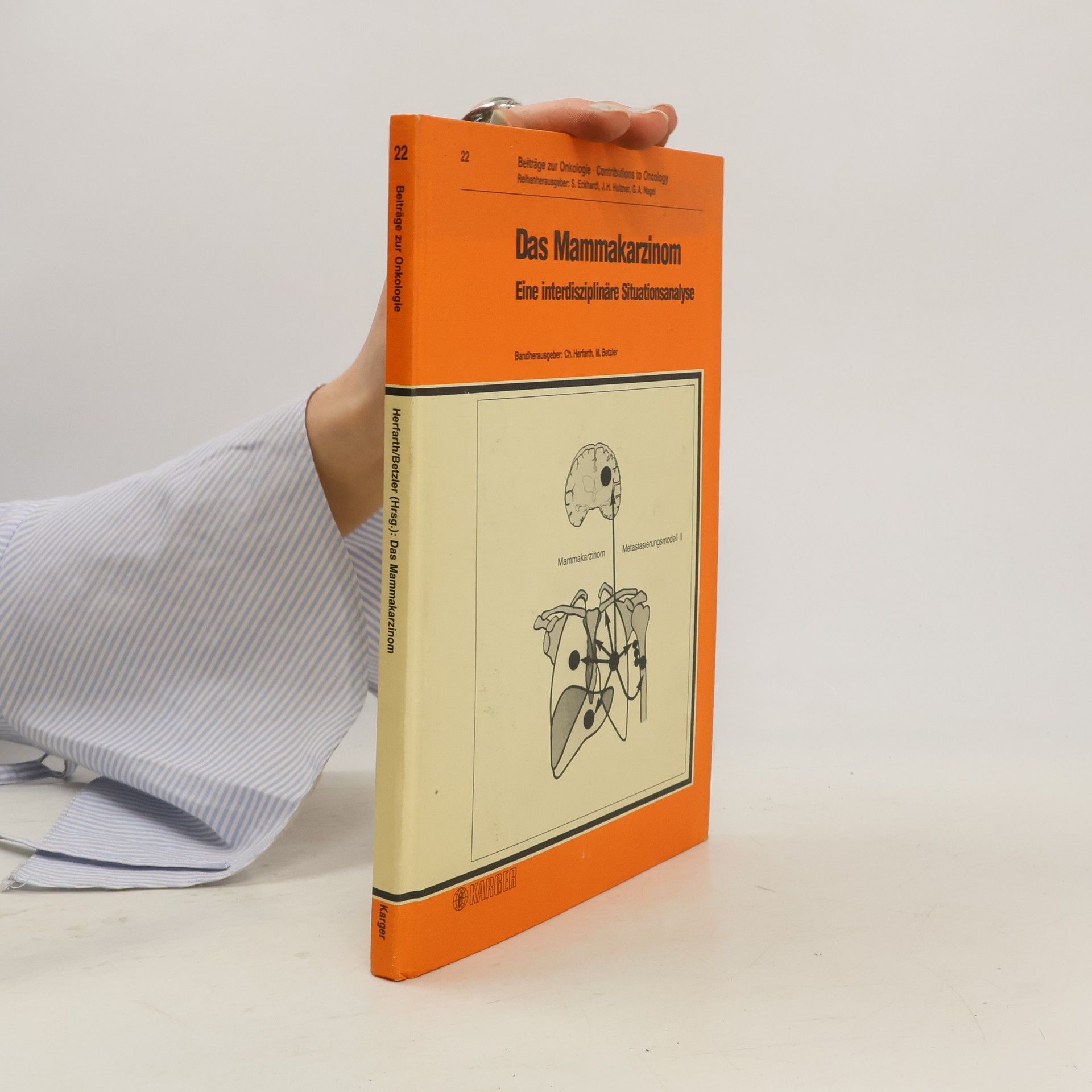 Christian Herfarth Beiträge zur Onkologie - 22: Das Mammakarzinom