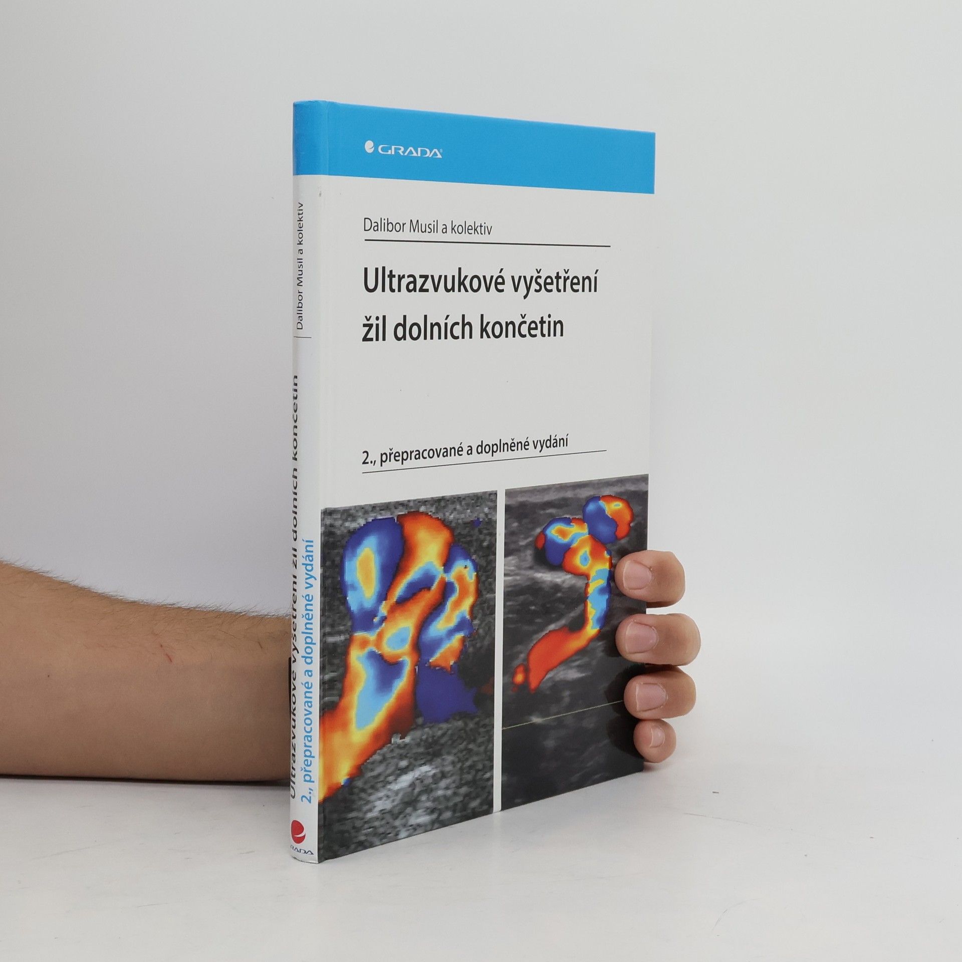 Dalibor Musil Ultrazvukové vyšetření žil dolních končetin