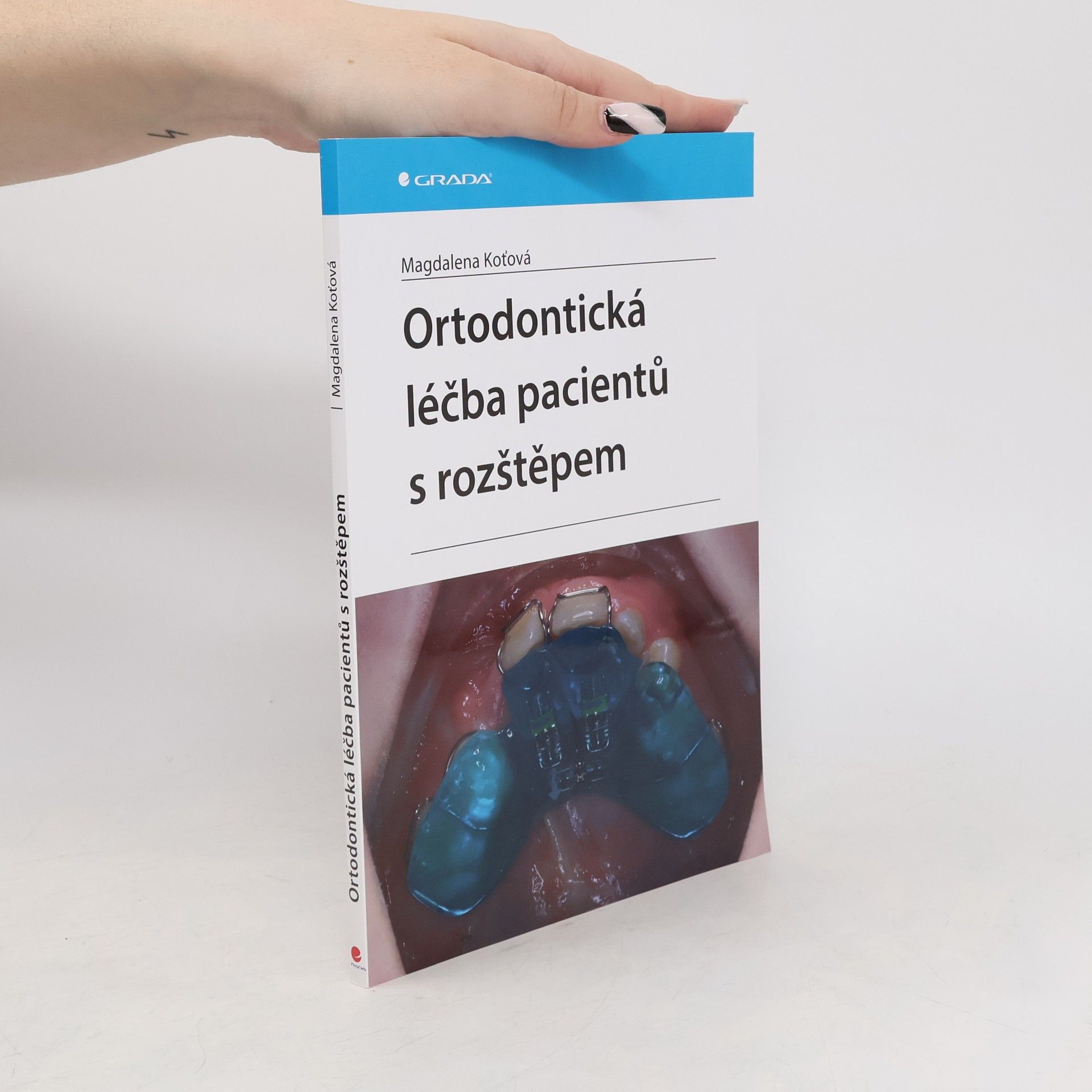 Ortodontická léčba pacientů s rozštěpem