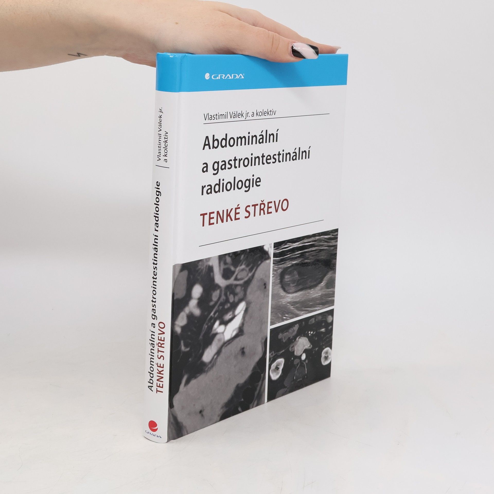 Vlastimil Válek Jr. Abdominální a gastrointestinální radiologie