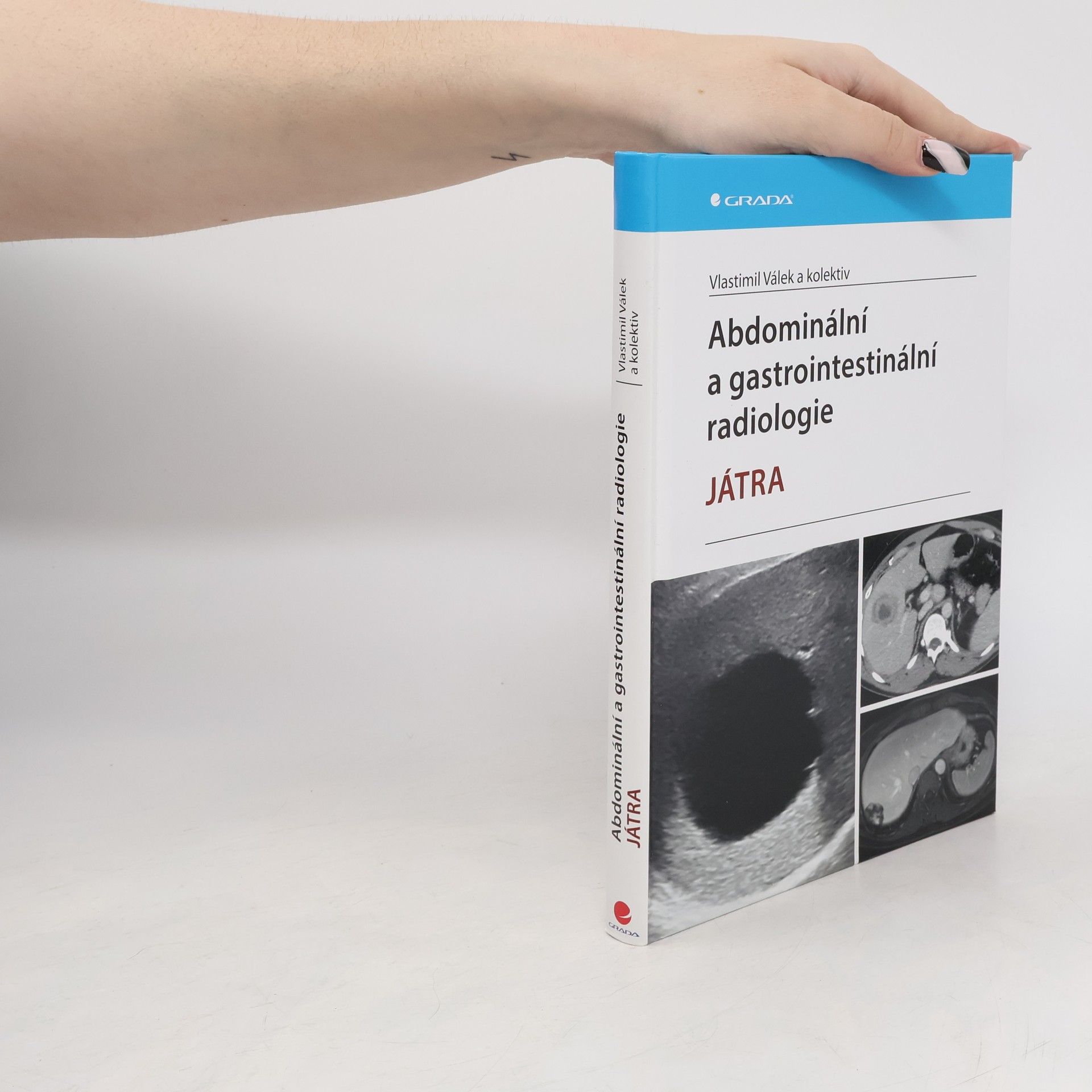Vlastimil Válek Abdominální a gastrointestinální radiologie - Játra