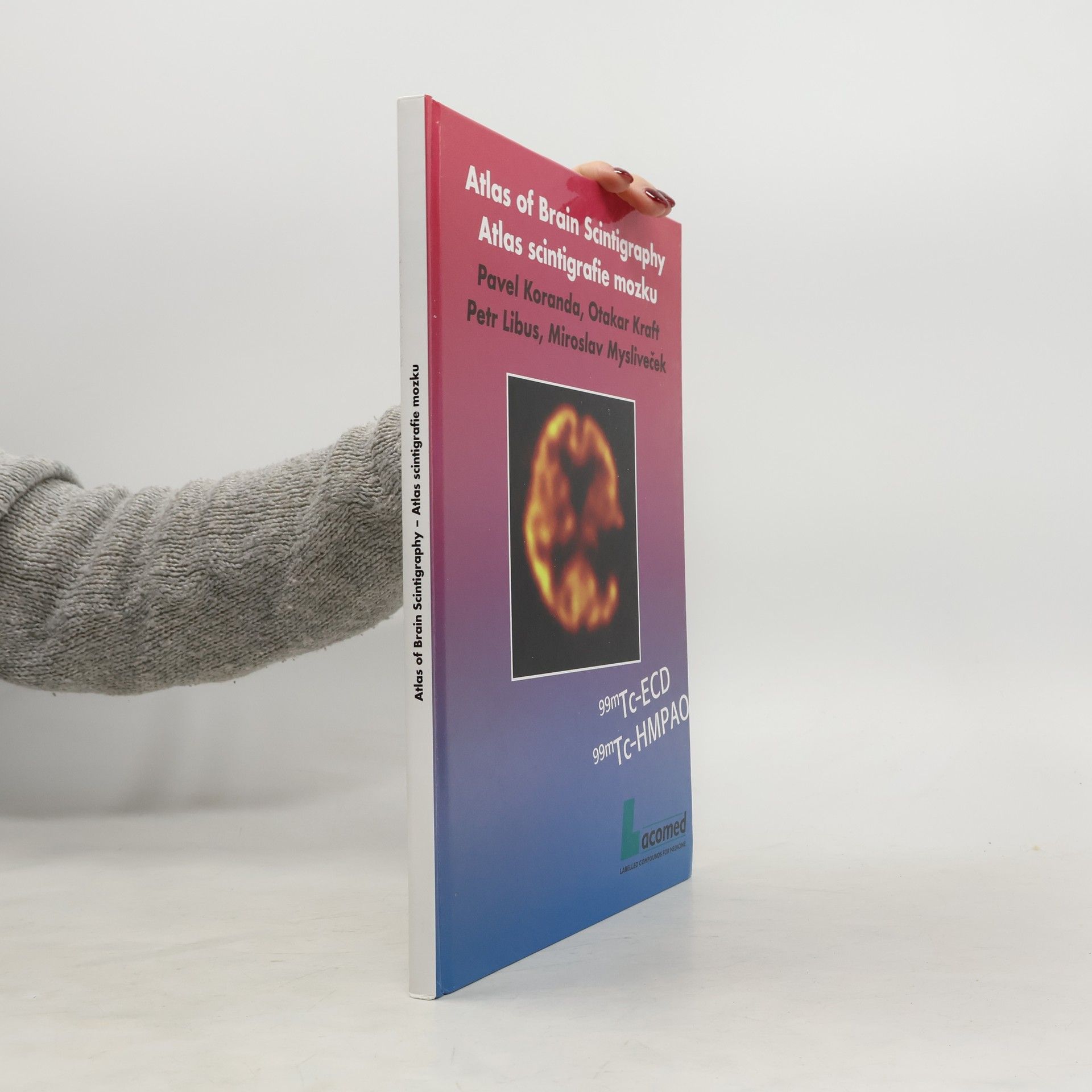 Kolektív autorov Atlas scintigrafie mozku = Atlas of brain scintigraphy