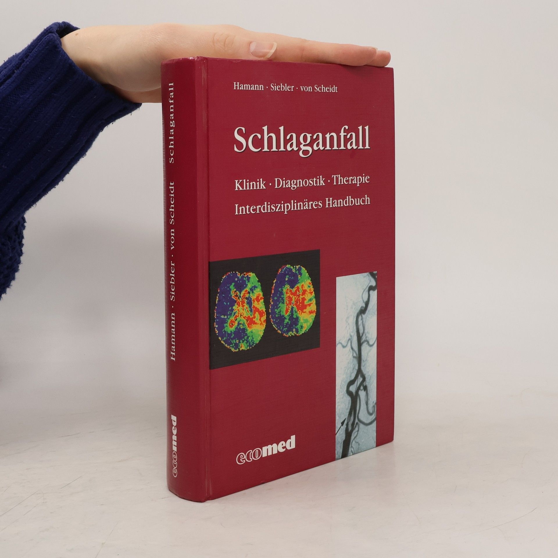 Hamann Schlaganfall. Klinik. Diagnostik. Therapie.