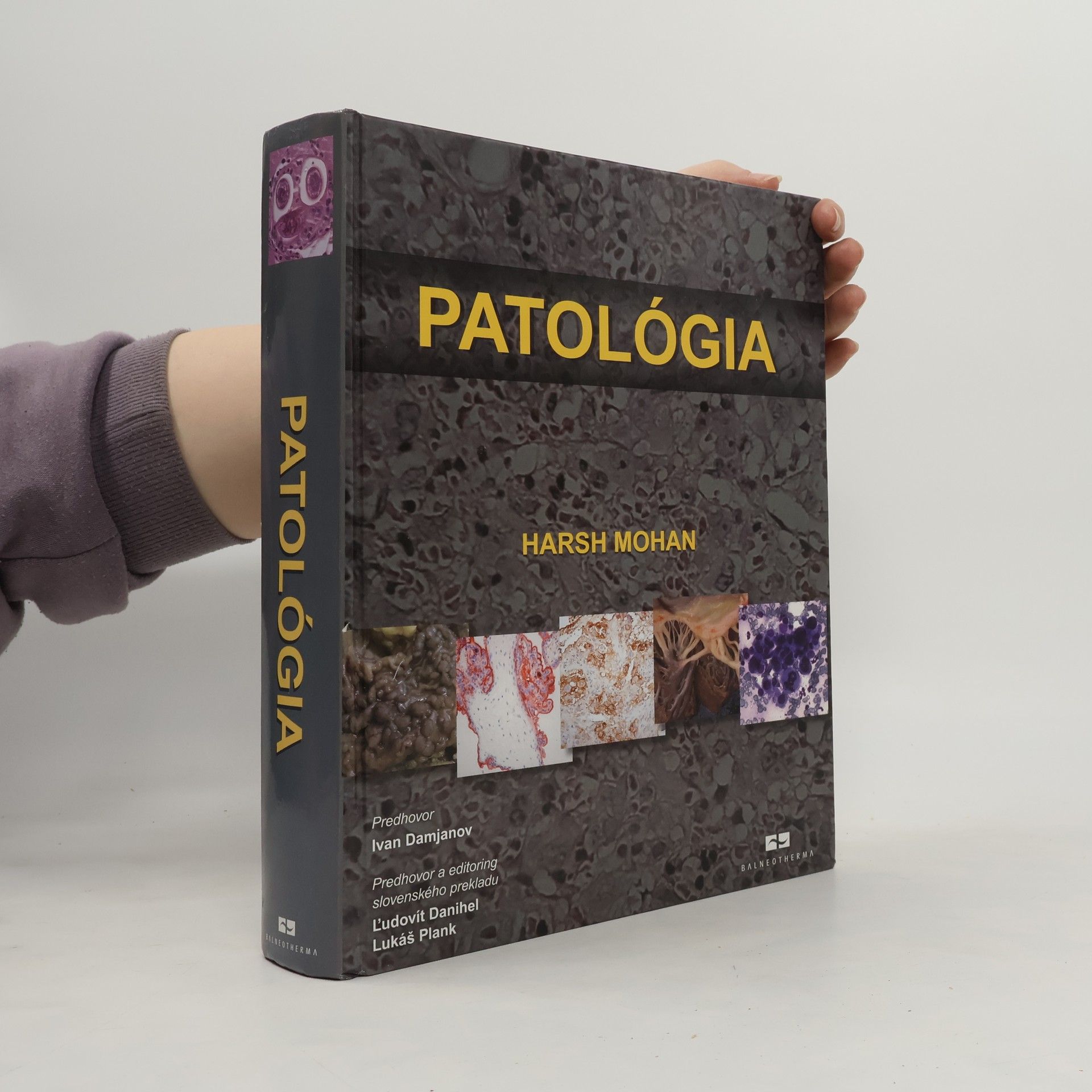 Harsh Mohan Patológia