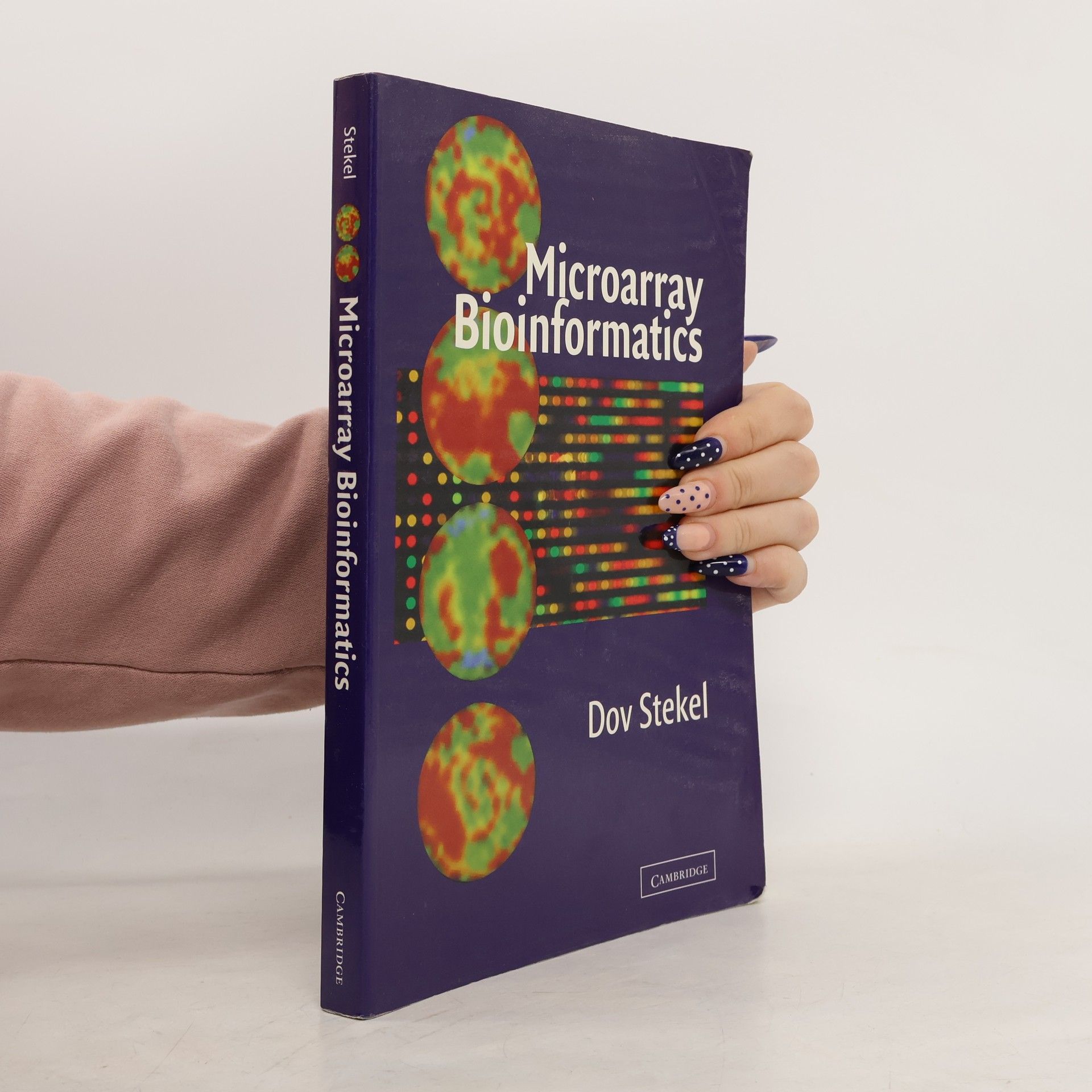 Dov Stekel Microarray Bioinformatics