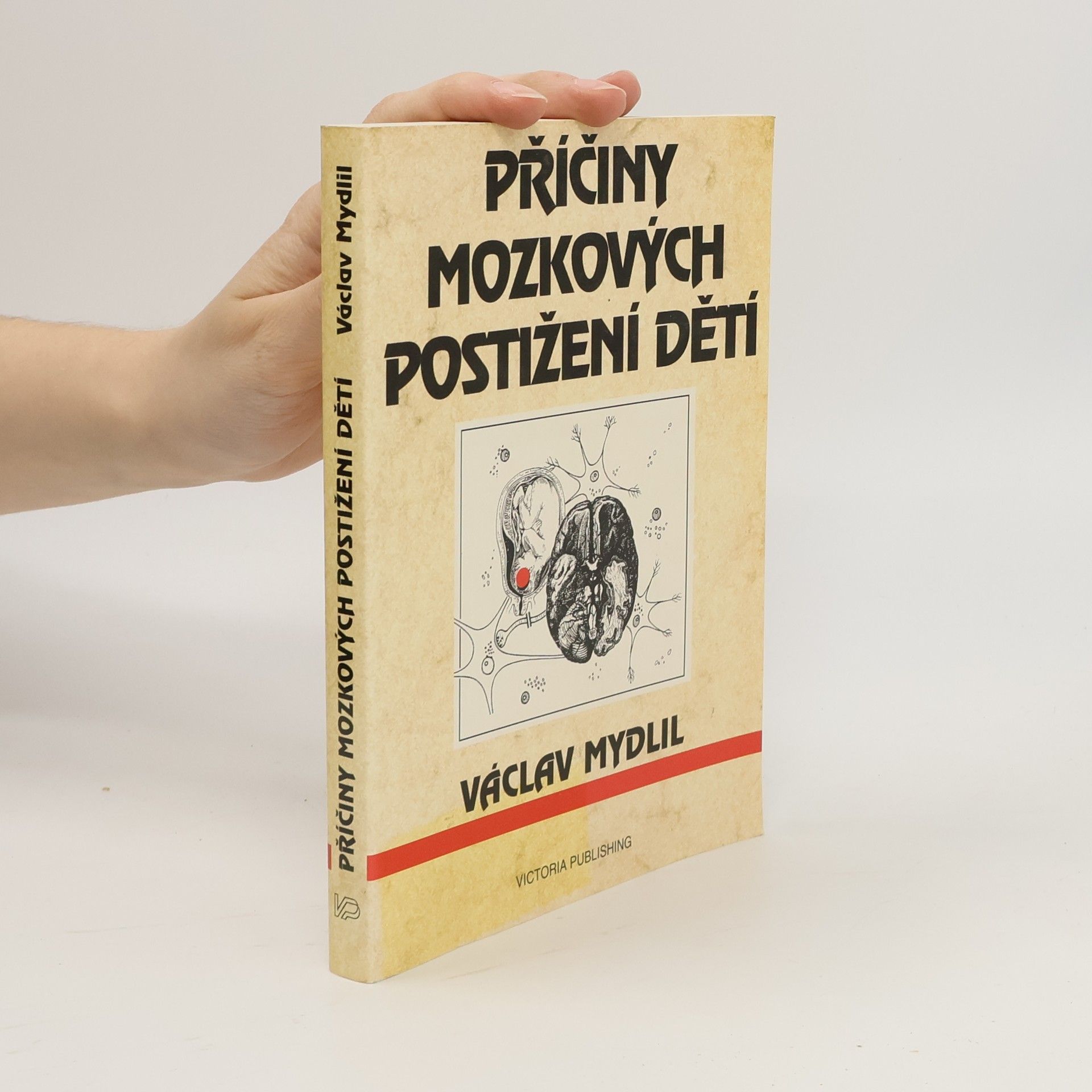 Václav Mydlil Příčiny mozkových postižení dětí