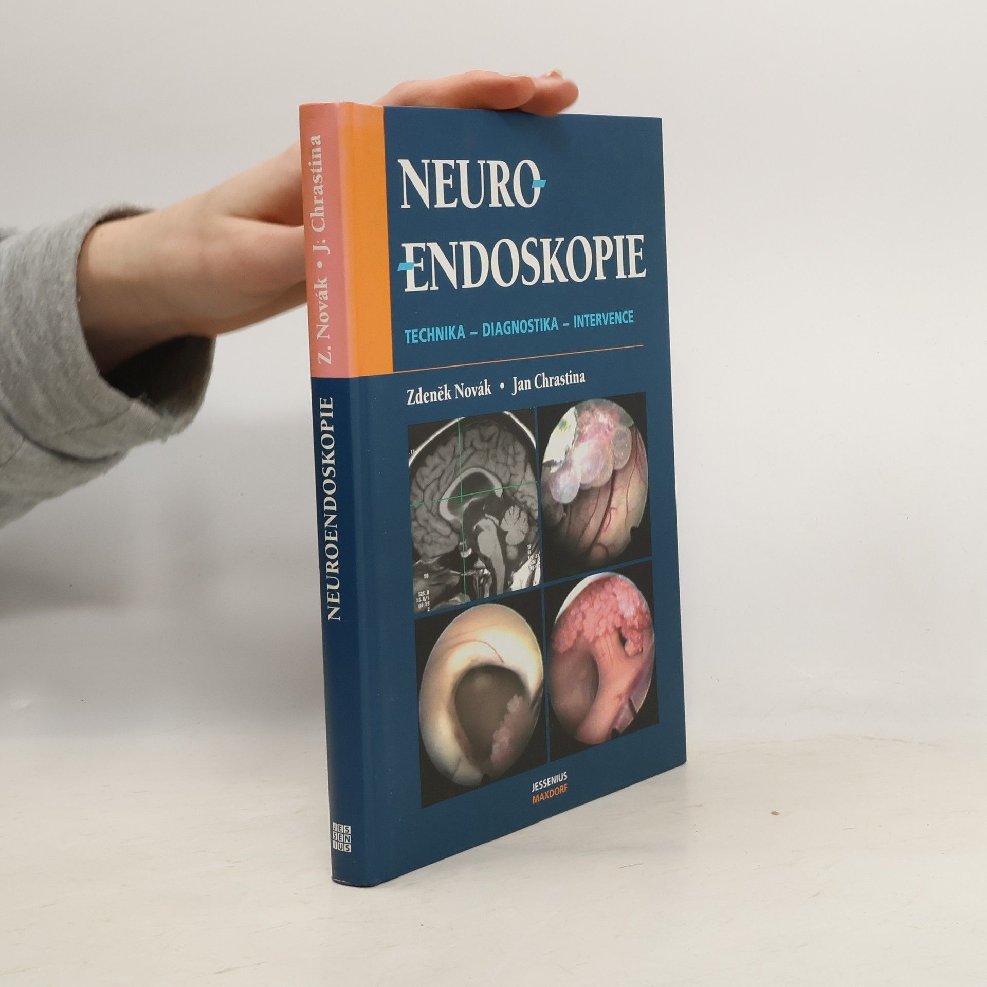 Zdeněk Novák Neuroendoskopie