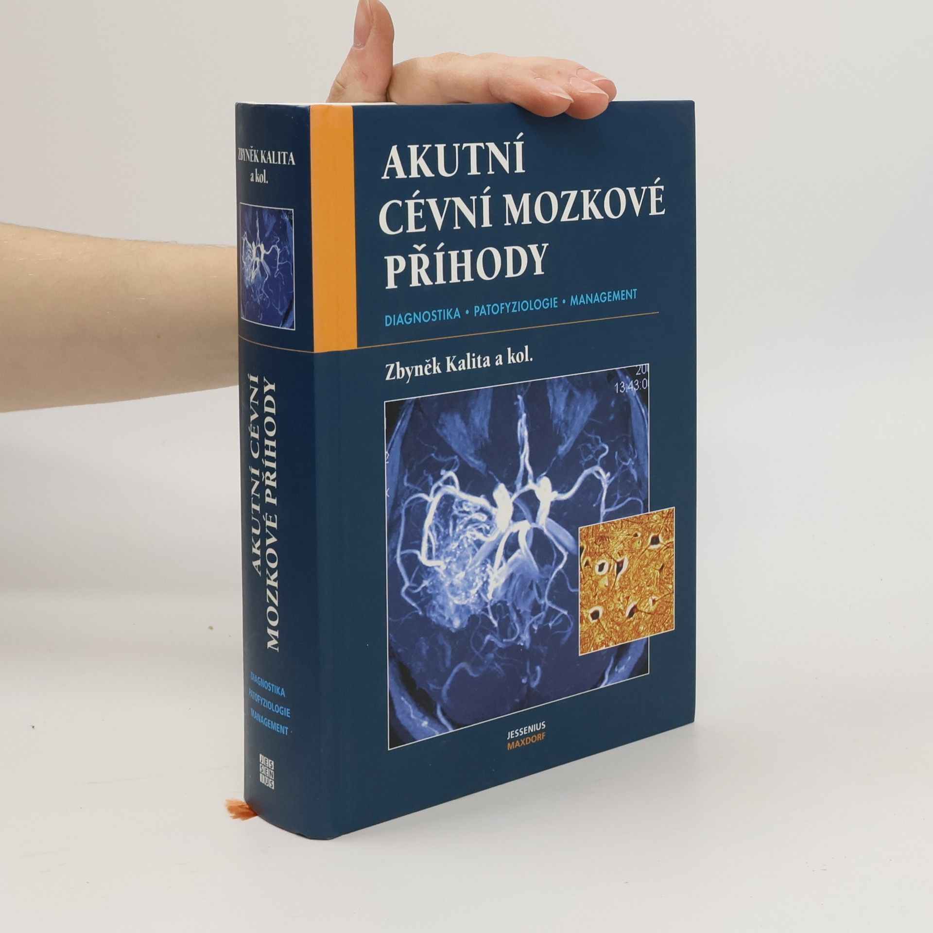 Zbyněk Kalita Akutní cévní mozkové příhody . diagnostika, patofyziologie, management