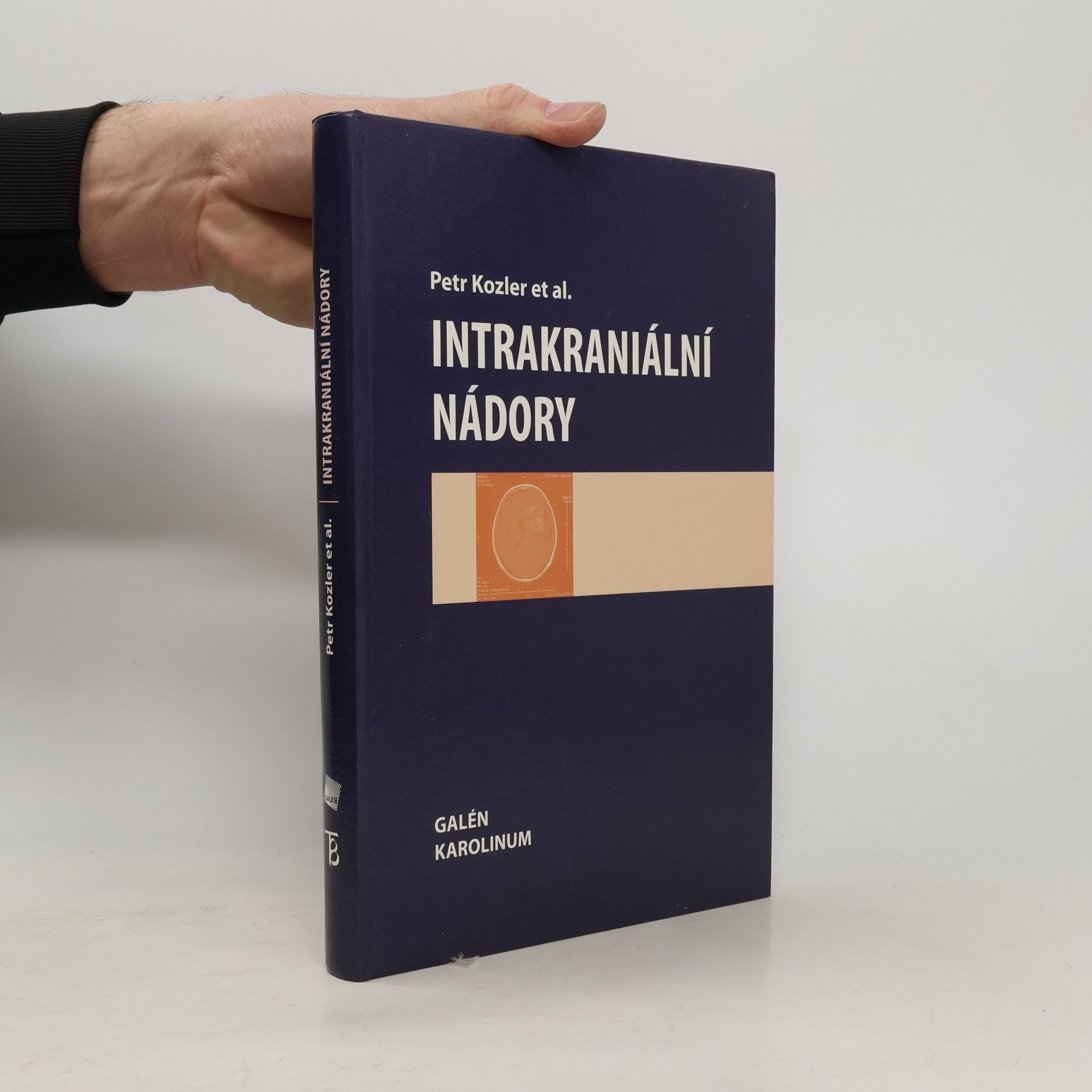 Petr Kozler Intrakraniální nádory
